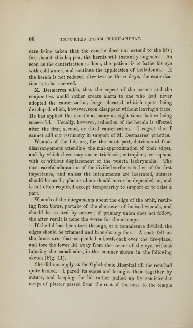 care being taken that the caustic does not extend to the iris; for, should this happen, the hernia will instantly augment. As soon as the cauterization is done, the patient is to bathe his eye with cold water, and continue the application of belladonna. If the hernia is not reduced after two or three days, the cauteriza- tion is to be renewed. M. Desmarres adds, that the aspect of the cornea and the conjunctiva would rather create alarm to one who had never adopted the cauterization, large elevated whitish spots being developed, which, however, soon disappear without leaving a trace. He has applied the caustic as many as eight times before being successful. Usually, however, reduction of the hernia is effected after the first, second, or third cauterization. I regret that I cannot add my testimony in support of M. Desmarres' practice. Wounds of the lids are, for the most part, detrimental from disarrangement attending the mal-approximation of their edges, and by which there may ensue trichiasis, entropium, ectropium, with or without displacement of the puncta lachrymalia. The most careful adaptation of the divided surfaces is then of the first importance, and unless the integuments are lacerated, sutures should be used ; plaster alone should never be depended on, and is not often required except temporarily to support or to raise a part. Wounds of the integuments about the edge of the orbit, result- ing from blows, partake of the character of incised wounds, and should be treated by suture; if primary union does not follow, the after result is none the worse for the attempt. If the lid has been torn through, or a commissure divided, the edges should be trimmed and brought together. A cook fell on the brass arm that suspended a bottle-jack over the fire-place, and tore the lower lid away from the corner of the eye, without injuring the canaliculus, in the manner shown in the following sketch (Fig. 11). She did not apply at the Ophthalmic Hospital till the rent had quite healed. I pared its edges and brought them together by suture, and keeping the lid rather pulled up by semicircular strips of plaster passed from the root of the nose to the temple