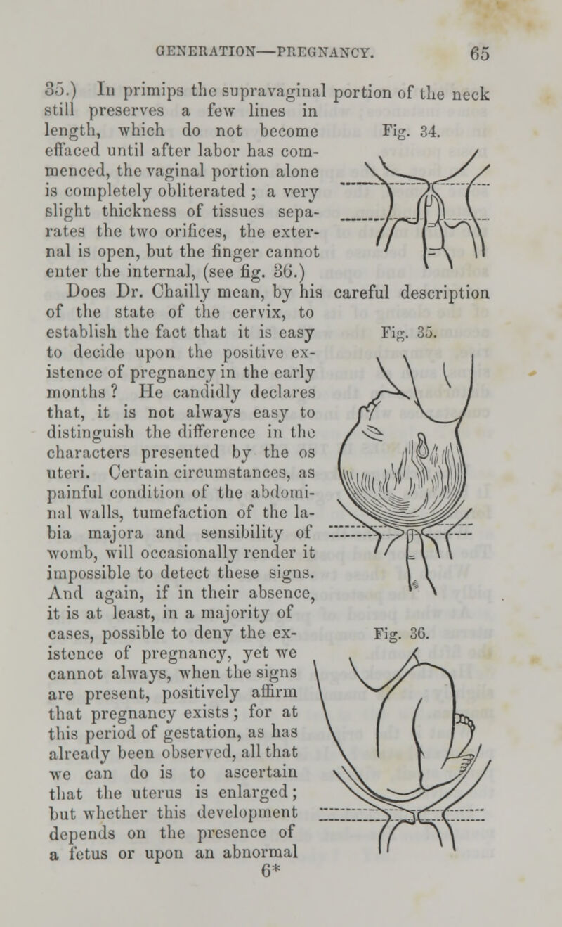 Fij Fie. 3.3. 3o.) In primips the supravaginal portion of the neck still preserves a few lines in length, which do not become effaced until after labor has com- menced, the vaginal portion alone is completely obliterated ; a very- slight thickness of tissues sepa- rates the two orifices, the exter- nal is open, but the finger cannot enter the internal, (see fig. 36.) Does Dr. Chailly mean, by his careful description of the state of the cervix, to establish the fact that it is easy to decide upon the positive ex- istence of pregnancy in the early months ? He candidly declares that, it is not always easy to distinguish the difference in the characters presented by the os uteri. Certain circumstances, as painful condition of the abdomi- nal walls, tumefaction of the la- bia majora and sensibility of womb, will occasionally render it impossible to detect these signs. And again, if in their absence, it is at least, in a majority of cases, possible to deny the ex- istence of pregnancy, yet we cannot always, when the signs arc present, positively affirm that pregnancy exists; for at this period of gestation, as has already been observed, all that we can do is to ascertain that the uterus is enlarged; but whether this development depends on the presence of a fetus or upon an abnormal 6* Fisr. 36.