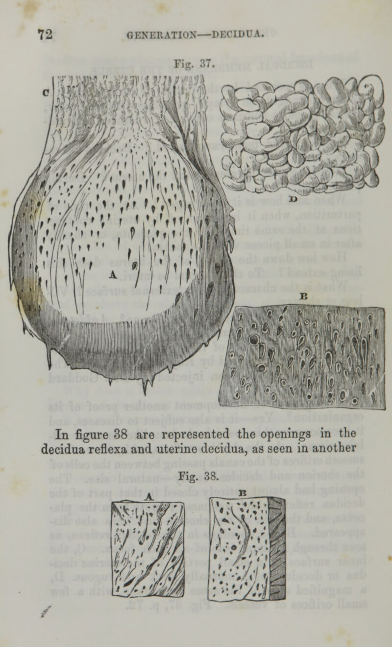 Kjp. 87. In figure 38 are represented the openings in the decidua reflexa and uterine decidua, as seen in another Fig. 38. B ''••.••/v-SI