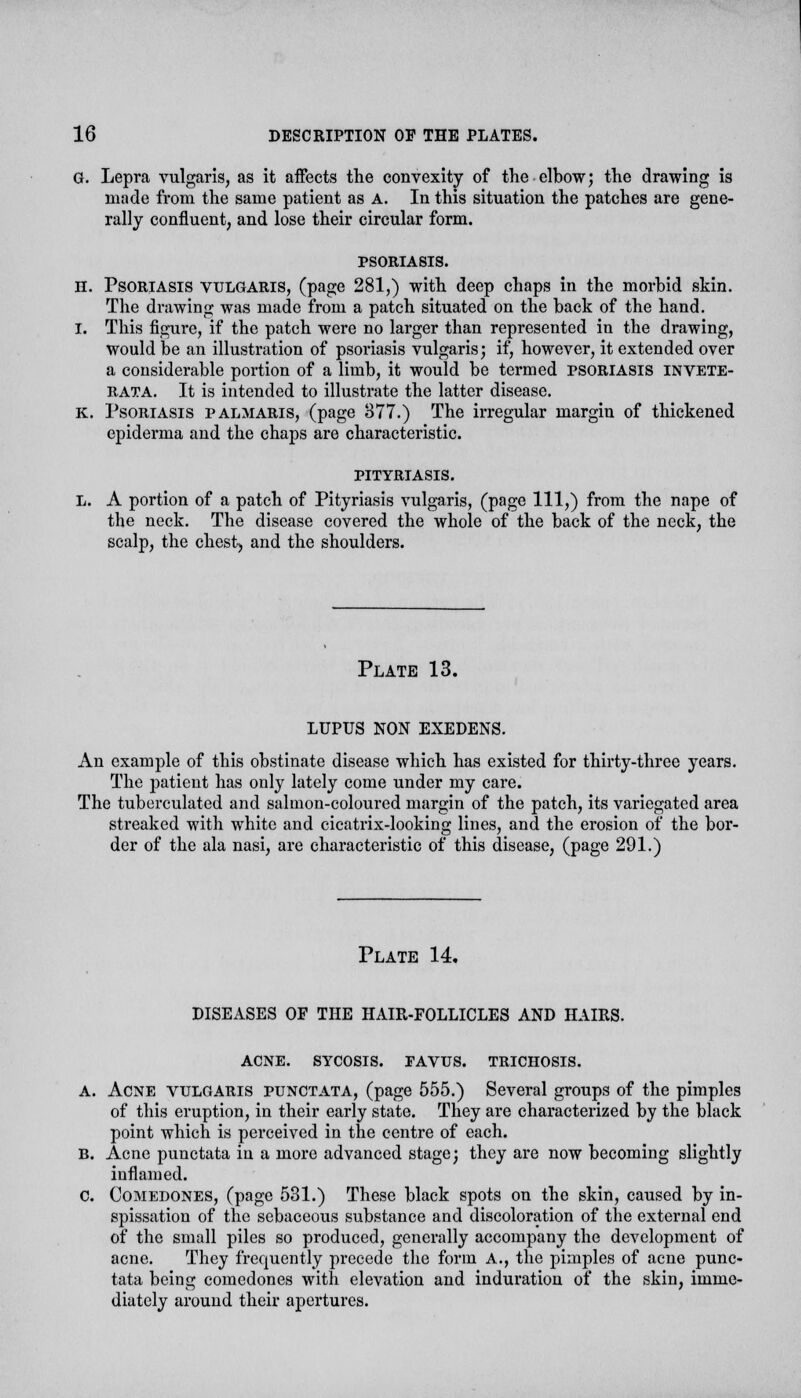 G. Lepra vulgaris, as it affects the convexity of the elbow; the drawing is made from the same patient as A. In this situation the patches are gene- rally confluent, and lose their circular form. PSORIASIS. n. Psoriasis vulgaris, (page 281,) with deep chaps in the morbid skin. The drawing was made from a patch situated on the back of the hand. I. This figure, if the patch were no larger than represented in the drawing, would be an illustration of psoriasis vulgaris; if, however, it extended over a considerable portion of a limb, it would be termed psoriasis invete- rata. It is intended to illustrate the latter disease. k. Psoriasis palmaris, (page 377.) The irregular margin of thickened epiderma and the chaps are characteristic. PITYRIASIS. l. A portion of a patch of Pityriasis vulgaris, (page 111,) from the nape of the neck. The disease covered the whole of the back of the neck, the scalp, the chest, and the shoulders. Plate 13. LUPUS NON EXEDENS. An example of this obstinate disease which has existed for thirty-three years. The patient has only lately come under my care. The tuberculated and salmon-coloured margin of the patch, its variegated area streaked with white and cicatrix-looking lines, and the erosion of the bor- der of the ala nasi, are characteristic of this disease, (page 291.) Plate 14. DISEASES OF THE HAIR-FOLLICLES AND HAIRS. ACNE. SYCOSIS. FAVUS. TRICHOSIS. A. Acne vulgaris punctata, (page 555.) Several groups of the pimples of this eruption, in their early state. They are characterized by the black point which is perceived in the centre of each. B. Acne punctata in a more advanced stage; they are now becoming slightly inflamed. C. Comedones, (page 531.) These black spots on the skin, caused by in- spissation of the sebaceous substance and discoloration of the external end of the small piles so produced, generally accompany the development of acne. They frequently precede the form A., the pimples of acne punc- tata being comedones with elevation and induration of the skin, imme- diately around their apertures.