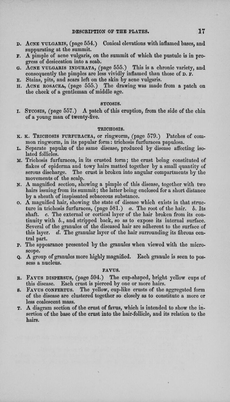 D. Acne vulgaris, (page 554.) Conical elevations with inflamed bases, and suppurating at the summit. F. A pimple of acne vulgaris, on the summit of which the pustule is in pro- gress of desiccation into a scab. G. Acne vulgaris indurata, (page 555.) This is a chronic variety, and consequently the pimples are less vividly inflamed than those of D. F. E. Stains, pits, and scars left on the skin by acne vulgaris. H. Acne rosacea, (page 555.) The drawing was made from a patch on the cheek of a gentleman of middle age. SYCOSIS. I. Sycosis, (page 557.) A patch of this eruption, from the side of the chin of a young man of twenty-five. trichosis. k. k. Trichosis furfuracea, or ringworm, (page 579.) Patches of com- mon ringworm, in its papular form: trichosis furfuracea papulosa. L. Separate papulae of the same disease, produced by disease affecting iso- lated follicles. M. Trichosis furfuracea, in its crusted torm; the crust being constituted of flakes of epiderma and towy hairs matted together by a small quantity of serous discharge. The crust is broken into angular compartments by the movements of the scalp. N. A magnified section, showing a pimple of this disease, together with two hairs issuing from its summit; the latter being enclosed for a short distance by a sheath of inspissated sebaceous substance. O. A magnified hair, showing the state of disease which exists in that struc- ture in trichosis furfuracea, (page 581.) a. The root of the hair. b. Its shaft, c. The external or cortical layer of the hair broken from its con- tinuity with b., and stripped back, so as to expose its internal surface. Several of the granules of the diseased hair are adherent to the surface of this layer, d. The granular layer of the hair surrounding its fibrous cen- tral part. p. The appearance presented by the granules when viewed with the micro- scope. Q. A group of granules more highly magnified. Each granule is seen to pos- sess a nucleus. FAVUS. r. Favus dispersus, (page 594.) The cup-shaped, bright yellow cups of this disease. Each crust is pierced by one or more hairs. S. Favus confertus. The yellow, cup-like crusts of the aggregated form of the disease are clustered together so closely as to constitute a more or less coalescent mass. T. A diagram section of the crust of favus, which is intended to show the in- sertion of the base of the crust into the hair-follicle, and its relation to the hairs.