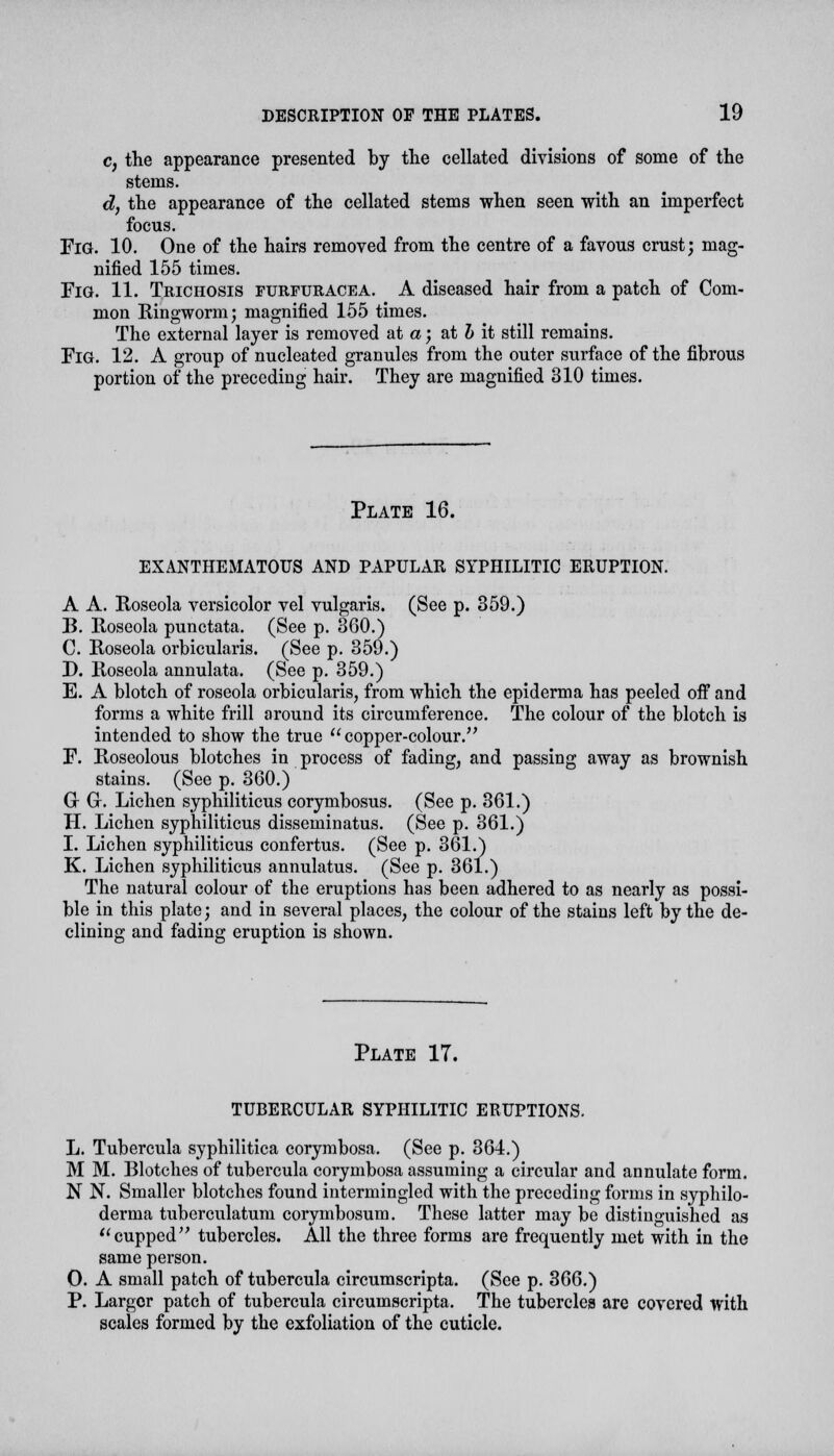c, the appearance presented by the cellated divisions of some of the stems. d, the appearance of the cellated stems when seen with an imperfect focus. Fig. 10. One of the hairs removed from the centre of a favous crust; mag- nified 155 times. Fig. 11. Trichosis furfuracea. A diseased hair from a patch of Com- mon Ringworm; magnified 155 times. The external layer is removed at a; at b it still remains. FiG. 12. A group of nucleated granules from the outer surface of the fibrous portion of the preceding hair. They are magnified 310 times. Plate 16. EXANTHEMATOUS AND PAPULAR SYPHILITIC ERUPTION. A A. Roseola versicolor vel vulgaris. (See p. 359.) B. Roseola punctata. (See p. 360.) C. Roseola orbicularis. (See p. 359.) D. Roseola annulata. (See p. 359.) E. A blotch of roseola orbicularis, from which the epiderma has peeled off and forms a white frill around its circumference. The colour of the blotch is intended to show the true copper-colour. F. Roseolous blotches in process of fading, and passing away as brownish stains. (See p. 360.) Gr G. Lichen syphiliticus corymbosus. (See p. 361.) H. Lichen syphiliticus disseminatus. (See p. 361.) I. Lichen syphiliticus confertus. (See p. 361.) K. Lichen syphiliticus annulatus. (See p. 361.) The natural colour of the eruptions has been adhered to as nearly as possi- ble in this plate; and in several places, the colour of the stains left by the de- clining and fading eruption is shown. Plate 17. TUBERCULAR SYPHILITIC ERUPTIONS. L. Tubercula syphilitica corymbosa. (See p. 364.) M M. Blotches of tubercula corymbosa assuming a circular and annulate form. N N. Smaller blotches found intermingled with the preceding forms in syphilo- derma tuberculatum corymbosum. These latter may be distinguished as cupped tubercles. All the three forms are frequently met with in the same person. 0. A small patch of tubercula circumscripta. (See p. 366.) P. Larger patch of tubercula circumscripta. The tuberclea are covered with scales formed by the exfoliation of the cuticle.