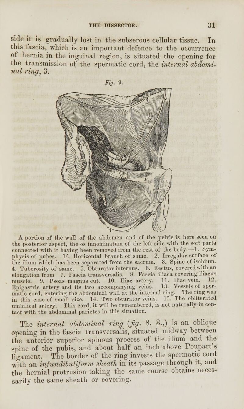 side it is gradually lost in the subserous cellular tissue. In this fascia, which is an important defence to the occurrence of hernia in the inguinal region, is situated the opening for the transmission of the spermatic cord, the internal abdomi- nal ring, 3. Fig. 9. A portion of the wall of the abdomen and of the pelvis is here seen on the posterior aspect, the os innominatum of the left side with the soft parts connected with it having been removed from the rest of the body.—1. Sym- physis of pubes. V. Horizontal branch of same. 2. Irregular surface of the ilium which has been separated from the sacrum. 3. Spine of ischium. 4. Tuberosity of same. 5. Obturator internus. 6. Rectus, covered with an elongation from 7. Fascia transversalis. 8. Fascia iliaca covering iliacus muscle. 9. Psoas magnus cut. 10. Iliac artery. 11. Iliac vein. 12. Epigastric artery and its two accompanying veins. 13. Vessels of sper- matic cord, entering the abdominal wall at the internal ring. The ring was in this case of small size. 14. Two obturator veins. 15. The obliterated umbilical artery. This cord, it will be remembered, is not naturally in con- tact with the abdominal parietes in this situation. The internal abdominal ring^ {fig. 8. 3.,) is an oblique opening in the fascia transversalis, situated midway between the anterior superior spinous process of the ilium and the spine of the pubis, and about half an inch above Poupart's ligament. The border of the ring invests the spermatic cord with an infundibuliform sheath in its passage through it, and the hernial protrusion taking the same course obtains neces- sarily the same sheath or covering.