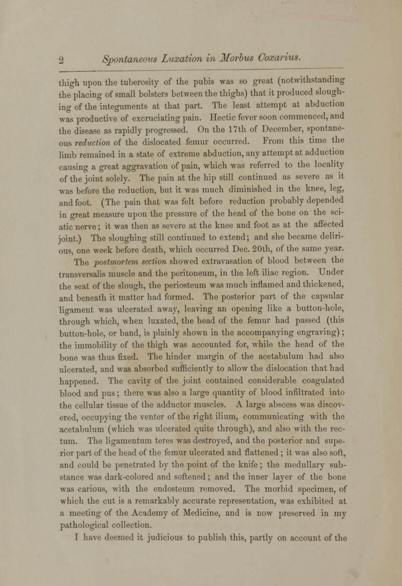 thigh upon the tuberosity of the pubis was so great (notwithstanding the placing of small bolsters between the thighs) that it produced slough- ing of the integuments at tbat part. The least attempt at abduction was productive of excruciating pain. Hectic fever soon commenced, and the disease as rapidly progressed. On the 17th of December, spontane- ous reduction of the dislocated femur occurred. From this time the limb remained in a state of extreme abduction, any attempt at adduction causing a great aggravation of pain, which was referred to the locality of the joint solely. The pain at the hip still continued as severe as it was before the reduction, but it was much diminished in the knee, leg, and foot. (The pain that was felt before reduction probably depended in great measure upon the pressure of the head of the bone on the sci- atic nerve; it was then as severe at the knee and foot as at the affected joint.) The sloughing still continued to extend; and she became deliri- ous, one week before death, which occurred Dec. 20th, of the same year. The postmortem section showed extravasation of blood between the transversalis muscle and the peritoneum, in the left iliac region. Under the seat of the slough, the periosteum was much inflamed and thickened, and beneath it matter had formed. The posterior part of the capsular ligament was ulcerated away, leaving an opening like a button-hole, through which, when luxated, the head of the femur had passed (this button-hole, or band, is plainly shown in the accompanying engraving); the immobility of the thigh was accounted for, Avhile the head of the bone was thus fixed. The hinder margin of the acetabulum had also ulcerated, and was absorbed sufficiently to allow the dislocation that had happened. The cavity of the joint contained considerable coagulated blood and pus; there was also a large quantity of blood infiltrated into the cellular tissue of the adductor muscles. A large abscess was discov- ered, occupying the venter of the right ilium, communicating with the acetabulum (which was ulcerated quite through), and also with the rec- tum. The ligamentum teres was destroyed, and the posterior and supe- rior part of the head of the femur ulcerated and flattened ; it was also soft, and could be penetrated by the point of the knife; the medullary sub- stance was dark-colored and softened; and the inner layer of the bone was carious, with the endosteum removed. The morbid specimen, of which the cut is a remarkably accurate representation, was exhibited at a meeting of the Academy of Medicine, and is now preserved in my pathological collection.