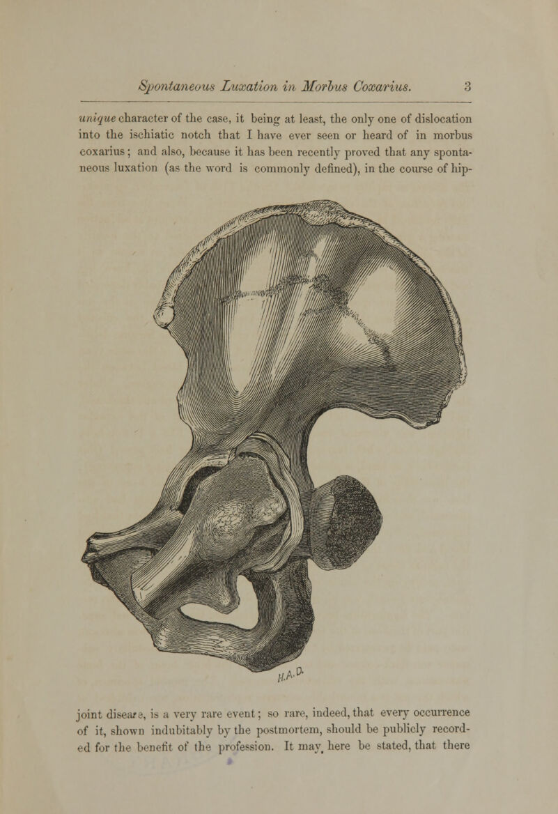 unique character of the case, it being at least, the only one of dislocation into the ischiatic notch that I have ever seen or heard of in morbus coxarius; and also, because it has been recently proved that any sponta- neous luxation (as the word is commonly defined), in the course of hip- joint disea/e, is a very rare event; so rare, indeed,that every occurrence of it, shown indubitably by the postmortem, should be publicly record- ed fur the benefit of the profession. It may, here be stated, that there