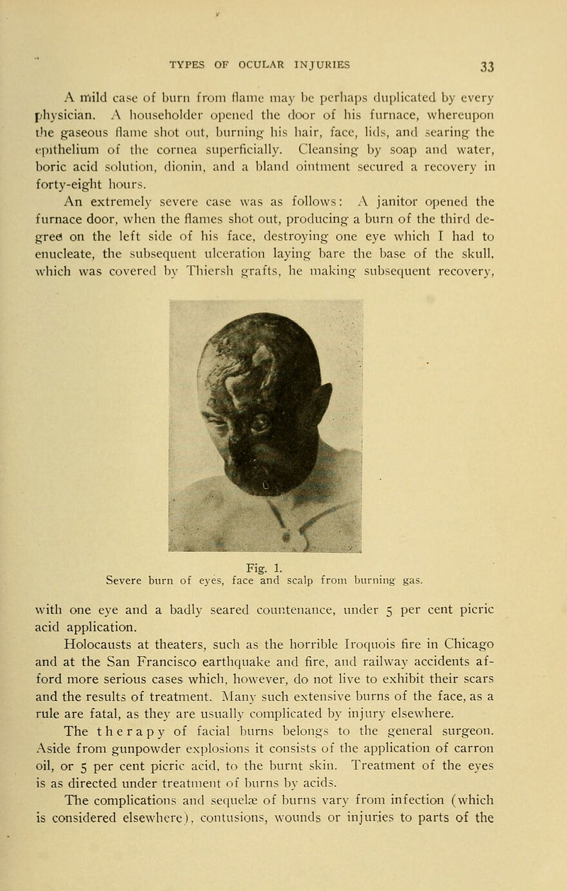 A mild case of burn from flame may be perhaps duplicated by every physician. A householder opened the door of his furnace, whereupon the gaseous flame shot out, burning his hair, face, lids, and searing the epithelium of the cornea superficially. Cleansing by soap and water, boric acid solution, dionin, and a bland ointment secured a recovery in forty-eight hours. An extremely severe case was as follows: A janitor opened the furnace door, when the flames shot out, producing a burn of the third de- gree on the left side of his face, destroying one eye which I had to enucleate, the subsequent ulceration laying bare the base of the skull, which was covered by Thiersh grafts, he making subsequent recovery, Fig. 1. Severe burn of eyes, face and scalp from burning gas. with one eye and a badly seared countenance, under 5 per cent picric acid application. Holocausts at theaters, such as the horrible Iroquois fire in Chicago and at the San Francisco earthquake and fire, and railway accidents af- ford more serious cases which, however, do not live to exhibit their scars and the results of treatment. Many such extensive burns of the face, as a rule are fatal, as they are usually complicated by injury elsewhere. The therapy of facial burns belongs to the general surgeon. Aside from gunpowder explosions it consists of the application of carron oil, or 5 per cent picric acid, to the burnt skin. Treatment of the eyes is as directed under treatment of burns by acids. The complications and sequelae of burns vary from infection (which is considered elsewhere), contusions, wounds or injuries to parts of the