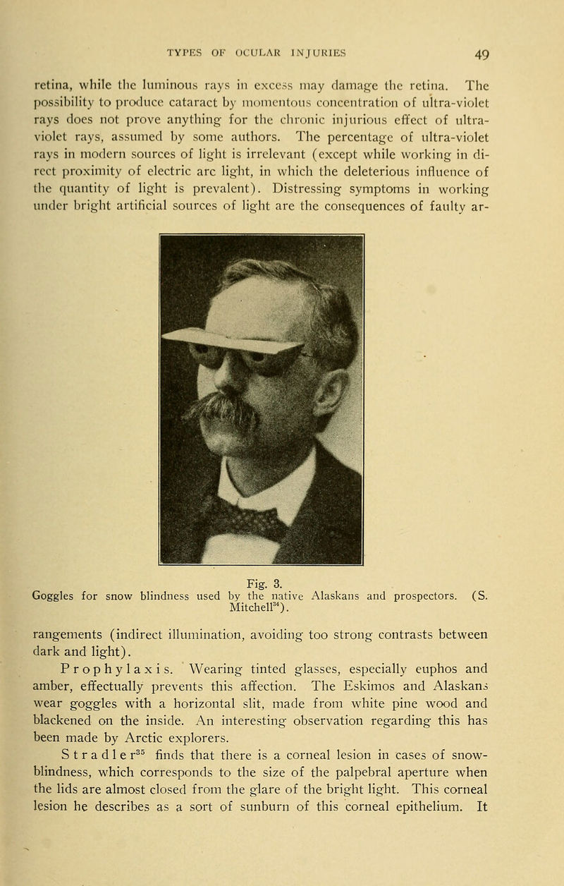 retina, while the luminous rays in excess may damage the retina. The possibility to produce cataract by momentous concentration of ultra-violet rays does not prove anything- for the chronic injurious effect of ultra- violet rays, assumed by some authors. The percentage of ultra-violet rays in modern sources of light is irrelevant (except while working in di- rect proximity of electric arc light, in which the deleterious influence of the quantity of light is prevalent). Distressing symptoms in working under bright artificial sources of light are the consequences of faulty ar- Fig. 3. Goggles for snow blindness used by the native Alaskans and prospectors. Mitchell34). (S. rangements (indirect illumination, avoiding too strong contrasts between dark and light). Prophylaxis. Wearing tinted glasses, especially euphos and amber, effectually prevents this affection. The Eskimos and Alaskans wear goggles with a horizontal slit, made from white pine wood and blackened on the inside. An interesting observation regarding this has been made by Arctic explorers. S t r a d 1 e r35 finds that there is a corneal lesion in cases of snow- blindness, which corresponds to the size of the palpebral aperture when the lids are almost closed from the glare of the bright light. This corneal lesion he describes as a sort of sunburn of this corneal epithelium. It