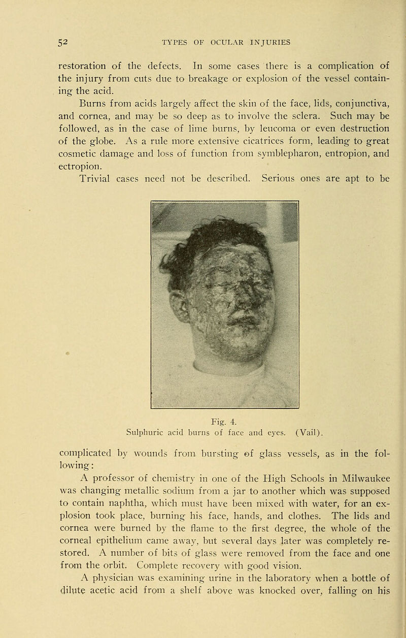 restoration of the defects. In some cases there is a complication of the injury from cuts due to breakage or explosion of the vessel contain- ing the acid. Burns from acids largely affect the skin of the face, lids, conjunctiva, and cornea, and may be so deep as to involve the sclera. Such may be followed, as in the case of lime burns, by leucoma or even destruction of the globe. As a rule more extensive cicatrices form, leading to great cosmetic damage and loss of function from symblepharon, entropion, and ectropion. Trivial cases need not be described. Serious ones are apt to be Fig. 4. Sulphuric acid burns of face and eyes. (Vail). complicated by wounds from bursting of glass vessels, as in the fol- lowing : A professor of chemistry in one of the High Schools in Milwaukee was changing metallic sodium from a jar to another which was supposed to contain naphtha, which must have been mixed with water, for an ex- plosion took place, burning his face, hands, and clothes. The lids and cornea were burned by the flame to the first degree, the whole of the corneal epithelium came away, but several days later was completely re- stored. A number of bits of glass were removed from the face and one from the orbit. Complete recovery with good vision. A physician was examining urine in the laboratory when a bottle of dilute acetic acid from a shelf above was knocked over, falling on his
