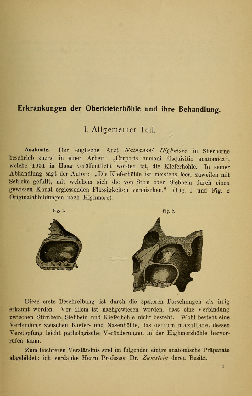 Erkrankungen der Oberkieferhöhle und ihre Behandlung. I. Allgemeiner Teil. Anatomie. Der englische Arzt Nathanael Highmore in Sherborne beschrieb zuerst in einer Arbeit: „Corporis humani disquisitio anatomica, welche 1651 in Haag- veröffentlicht worden ist, die Kieferhöhle. In seiner Abhandlung sagt der Autor: „Die Kieferhöhle ist meistens leer, zuweilen mit Schleim gefüllt, mit welchem sich die von Stirn oder Siebbein durch einen gewissen Kanal ergiessenden Flüssigkeiten vei'mischen. (Fig. 1 und Fig. 2 Originalabbildungen nach Highmore). Fig. 1. Fig. 2. Diese erste Beschreibung ist durch die späteren Forschungen als irrig erkannt worden. Vor allem ist nachgewiesen Avorden, dass eine A^erbindung zwischen Stirnbein, Siebbein und Kieferhöhle nicht besteht. Wohl besteht eine Verbindung zwischen Kiefer- und Nasenhöhle, das ostium maxillare, dessen Verstopfung leicht pathologische Veränderungen in der Highmorshöhle hervor- rufen kann. Zum leichteren Verständnis sind im folgenden einige anatomische Präparate abgebildet; ich verdanke Herrn Professor Dr. Zumstein deren Besitz.