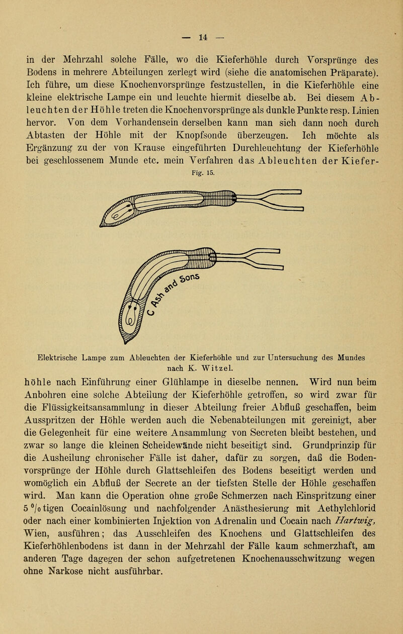 in der Mehrzahl solche Fälle, wo die Kieferhöhle durch Vorspränge des Bodens in mehrere Abteilung-en zerleg-t wird (siehe die anatomischen Präparate). Ich führe, um diese Knochenvorsprüng-e festzustellen, in die Kieferhöhle eine kleine elektrische Lampe ein und leuchte hiermit dieselbe ab. Bei diesem Ab- leuchten der Höhle treten die Knochenvorsprünge als dunkle Punkte resp. Linien hervor. Von dem Vorhandensein derselben kann man sich dann noch durch Abtasten der Höhle mit der Knopfsonde überzeugen. Ich möchte als Ergänzung zu der von Krause eingeführten Durchleuchtung der Kieferhöhle bei geschlossenem Munde etc. mein Verfahren das Ableuchten der Kiefer- Fig. 15. Elektrische Lampe zum Ableuchten der Kieferhöhle und zur Untersuchung des Mundes nach K. Witzel. höhle nach Einführung einer Glühlampe in dieselbe nennen. Wird nun beim Anbohren eine solche Abteilung der Kieferhöhle getroffen, so wird zwar für die Flüssigkeitsansammlung in dieser Abteilung freier Abfluß geschaffen, beim Ausspritzen der Höhle werden auch die Nebenabteilungen mit gereinigt, aber die Gelegenheit für eine weitere Ansammlung von Secreten bleibt bestehen, und zwar so lange die kleinen Scheidewände nicht beseitigt sind. Grundprinzip für die Ausheilung chronischer Fälle ist daher, dafür zu sorgen, daß die Boden- vorsprünge der Höhle durch Glattschleifen des Bodens beseitigt werden und womöglich ein Abfluß der Secrete an der tiefsten Stelle der Höhle geschaffen wird. Man kann die Operation ohne große Schmerzen nach Einspritzung einer 5 °/o tigen Cocainlösung und nachfolgender Anästhesierung mit Aethylchlorid oder nach einer kombinierten Injektion von Adrenalin und Cocain nach Hartwig, Wien, ausführen; das Ausschleifen des Knochens und Glattschleifen des Kieferhöhlenbodens ist dann in der Mehrzahl der Fälle kaum schmerzhaft, am anderen Tage dagegen der schon aufgetretenen Knochenausschwitzung wegen ohne Narkose nicht ausführbar.