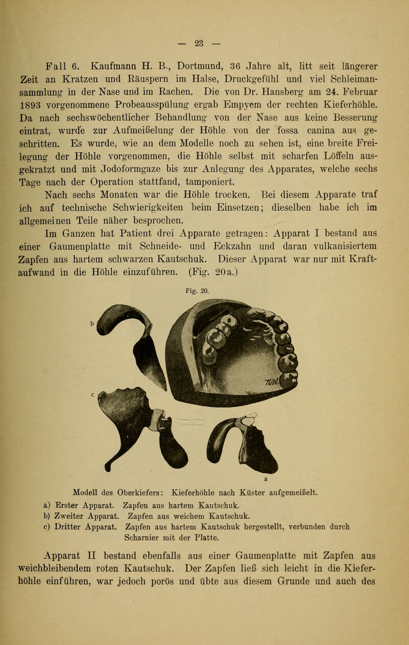 Fall 6. Kaufmann H. B., Dortmund, 36 Jahre alt, litt seit längerer Zeit an Kratzen und Räuspern im Halse, Druckgefühl und viel Schleiman- sammlung in der Nase und im Rachen. Die von Dr. Hansberg am 24. Februar 1893 vorgenommene Probeausspülung ergab Empyem der rechten Kieferhöhle. Da nach sechswöchentlicher Behandlung von der Nase aus keine Besserung eintrat, wurde zur Aufmeißelung der Höhle von der fossa canina aus ge- schritten. Es wurde, wie an dem Modelle noch zu sehen ist, eine breite Frei- legung der Höhle vorgenommen, die Höhle selbst mit scharfen Löffeln aus- gekratzt und mit Jodoformgaze bis zur Anlegung des Apparates, welche sechs Tage nach der Operation stattfand, tamponiert. Nach sechs Monaten war die Höhle trocken. Bei diesem Apparate traf ich auf technische Schwierigkeiten beim Einsetzen; dieselben habe ich im allgemeinen Teile näher besprochen. Im Ganzen hat Patient drei Apparate getragen: Apparat I bestand aus einer Gaumenplatte mit Schneide- und Eckzahn und daran vulkanisiertem Zapfen aus hartem schwarzen Kautschuk. Dieser Apparat war nur mit Kraft- aufwand in die Höhle einzuführen. (Fig. 20 a.) Fig. 20. Modell des Oberkiefers: Kieferhöhle nach Küster aufgemeißelt. a) Erster Apparat. Zapfen aus hartem Kautschuk. b) Zweiter Apparat. Zapfen aus weichem Kautschuk. c) Dritter Apparat. Zapfen aus hartem Kautschuk hergestellt, verbunden durch Scharnier mit der Platte. Apparat H bestand ebenfalls aus einer Gaumenplatte mit Zapfen aus weichbleibendem roten Kautschuk. Der Zapfen ließ sich leicht in die Kiefer- höhle einführen, war jedoch porös und übte aus diesem Grunde und auch des