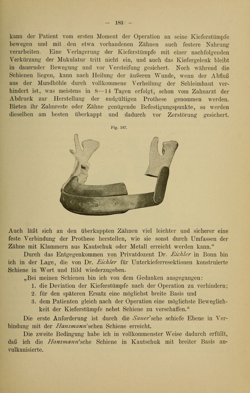 kann der Patient vom ersten Moment der Operation an seine Kieferstümpfe bewegen und mit den etwa vorhandenen Zälmen auch festere Nahrung verarbeiten. Eine Verlagerung der Kieferstümpfe mit einer nachfolgenden Verkürzung der Mukulatur tritt nicht ein, und auch das Kiefergelenk bleibt in dauernder Bewegung und vor Versteifung gesichert. Noch während die Schienen liegen, kann nach Heilung der äußeren Wunde, wenn der Abfluß aus der Mundhöhle durch vollkommene Verheilung der Schleimhaut ver- hindert ist, was meistens in 8—14 Tagen erfolgt, schon vom Zahnarzt der Abdruck zur Herstellung der endgültigen Prothese genommen werden. Bieten ihr Zahnreste oder Zähne genügende Befestigungspunkte, so werden dieselben am besten überkappt und dadurch vor Zerstörung gesichert. Fig. 187. Auch läßt sich an den überkappten Zähnen viel leichter und sicherer eine feste Verbindung der Prothese herstellen, wie sie sonst durch Umfassen der Zähne mit Klammern aus Kautschuk oder Metall erreicht werden kann. Durch das Entgegenkommen von Privatdozent Dr. Eichler in Bonn bin ich in der Lage, die von Dr. Eichler für Unterkieferresektionen konstruierte Schiene in Wort und Bild wiederzugeben. „Bei meinen Schienen bin ich von dem Gedanken ausgegangen: 1. die Deviation der Kieferstümpfe nach der Operation zu verhindern; 2. für den späteren Ersatz eine möglichst breite Basis und 3. dem Patienten gleich nach der Operation eine möglichste Beweglich- keit der Kieferstümpfe nebst Schiene zu verschaffen. Die erste Anforderung ist durch die Sauer'^o)^^ schiefe Ebene in Ver- bindung mit der Hansmann''^oh^u Schiene erreicht. Die zweite Bedingung habe ich in vollkommenster Weise dadurch erfüllt, daß ich die Hansmamt'^ohQ Schiene in Kautschuk mit breiter Basis an- vulkanisierte.