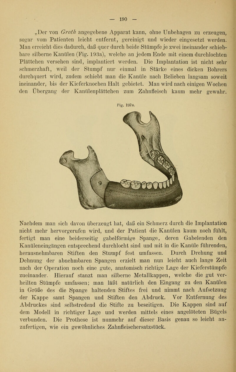 „Der von Groth angegebene Apparat kann, ohne Unbehagen zu erzeugen, sogar vom Patienten leicht entfernt, gereinigt und wieder eingesetzt werden. Man erreicht dies dadurch, daß quer durch beide Stümpfe je zwei ineinander schieb- bare silberne Kanülen (Fig. 193a), welche an jedem Ende mit einem durchlochten Plättchen versehen sind, implantiert werden. Die Implantation ist nicht sehr schmerzhaft, weil der Stumpf nur einmal in Stärke eines dicken Bohrers durchquert wird, zudem schiebt man die Kanüle nach Belieben langsam soweit ineinander, bis der Kieferknochen Halt gebietet. Man wird nach einigen Wochen den Übergang der Kanülenplättchen zum Zahnfleisch kaum mehr gewahr. Fig. 192 a. Nachdem man sich davon überzeugt hat, daß ein Schmerz durch die Implantation nicht mehr hervorgerufen wird, und der Patient die Kanülen kaum noch fühlt, fertigt man eine beiderseitig gabelförmige Spange, deren Gabelenden den Kanüleneingängen entsprechend durchlocht sind und mit in die Kanüle führenden, herausnehmbaren Stiften den Stumpf fest umfassen. Durch Drehung und Dehnung der abnehmbaren Spangen erzielt man nun leicht auch lange Zeit nach der Operation noch eine gute, anatomisch richtige Lage der Kieferstümpfe zueinander. Hierauf stanzt man silberne Metallkappen, welche die gut ver- heilten Stümpfe umfassen; man läßt natürlich den Eingang zu den Kanülen in Größe des die Spange haltenden Stiftes frei und nimmt nach Aufsetzung der Kappe samt Spangen und Stiften den Abdruck. Vor Entfernung des Abdruckes sind selbstredend die Stifte zu beseitigen. Die Kappen sind auf dem Modell in richtiger Lage und werden mittels eines angelöteten Bügels verbunden. Die Prothese ist nunmehr auf dieser Basis genau so leicht an- zufertigen, wie ein gewöhnliches Zahnfleischersatzstück.