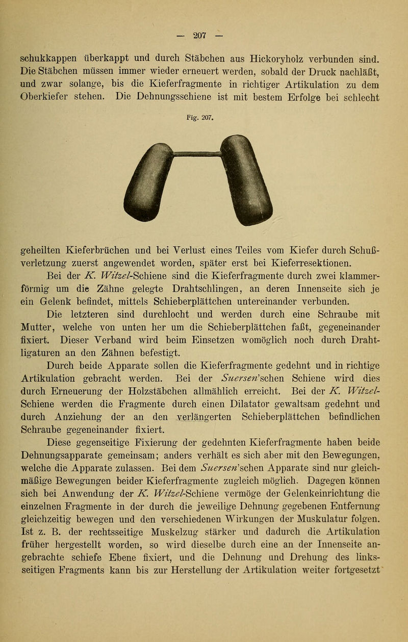 sehukkappen überkappt und durch Stäbchen aus Hickoryholz verbunden sind. Die Stäbchen müssen immer wieder erneuert werden, sobald der Druck nachläßt, und zwar solange, bis die Kieferfragmente in richtiger Artikulation zu dem Oberkiefer stehen. Die Dehnungsschiene ist mit bestem Erfolge bei schlecht Fig. 207. geheilten Kieferbrüchen und bei Verlust eines Teiles vom Kiefer durch Schuß- verletzung zuerst angewendet worden, später erst bei Kieferresektionen. Bei der K. fFz^z^Z-Schiene sind die Kieferfragmente durch zwei klammer- förmig um die Zähne gelegte Drahtschlingen, an deren Innenseite sich je ein Gelenk befindet, mittels Schieberplättchen untereinander verbunden. Die letzteren sind durchlocht und werden durch eine Schraube mit Mutter, welche von unten her um die Schieberplättchen faßt, gegeneinander fixiert. Dieser Verband wird beim Einsetzen womöglich noch durch Draht- ligaturen an den Zähnen befestigt. Durch beide Apparate sollen die Kieferfragmente gedehnt und in richtige Artikulation gebracht werden. Bei der Suersen'^oh'dVi Schiene wird dies durch Erneuerung der Holzstäbchen allmählich erreicht. Bei der K. Witzel- Schiene werden die Fragmente durch einen Diktator gewaltsam gedehnt und durch Anziehung der an den verlängerten Schieberplättchen befindlichen Schraube gegeneinander fixiert. Diese gegenseitige Fixierung der gedehnten Kieferfragmente haben beide Dehnungsapparate gemeinsam; anders verhält es sich aber mit den Bewegungen, welche die Apparate zulassen. Bei dem Suersen^Q^iQVL Apparate sind nui^ gleich- mäßige Bewegungen beider Kieferfragmente zugleich möglich. Dagegen können sich bei Anwendung der K. f^z/z^/-Schiene vermöge der Gelenkeinrichtung die einzelnen Fragmente in der durch die jeweilige Dehnung gegebenen Entfernung gleichzeitig bewegen und den verschiedenen Wirkungen der Muskulatur folgen. Ist z. B. der rechtsseitige Muskelzug stärker und dadurch die Artikulation früher hergestellt worden, so wird dieselbe durch eine an der Innenseite an- gebrachte schiefe Ebene fixiert, und die Dehnung and Drehung des links- seitigen Fragments kann bis zur Herstellung der Artikulation weiter fortgesetzt