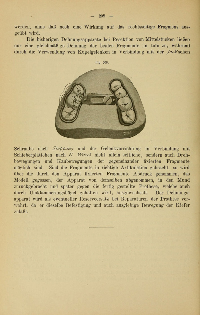 werden, ohne daß noch eine Wirkung auf das rechtsseitige Fragment aus- geübt wird. Die bisherigen Dehnungsapparate bei Resektion von Mittelstücken ließen nur eine gleichmäßige Dehnung der beiden Fragmente in toto zu, während durch die Verwendung von Kugelgelenken in Verbindung mit der /ack'sehen Fig. 208. Schraube nach Sto'ppany und der Gelenkvorrichtung in Verbindung mit Schieberplättchen nach K. Witzel nicht allein seitliche, sondern auch Dreh- bewegungen und Kaubewegungen der gegeneinander fixierten Fragmente möglich sind. Sind die Fragmente in richtige Artikulation gebracht, so wird über die durch den Apparat fixierten Fragmente Abdruck genommen, das Modell gegossen, der Apparat von demselben abgenommen, in den Mund zurückgebracht und später gegen die fertig gestellte Prothese, welche auch durch Umklammerungsbügel gehalten wird, ausgewechselt. Der Dehnungs- apparat wird als eventueller Reserveersatz bei Reparaturen der Prothese ver- wahrt, da er dieselbe Befestigung und auch ausgiebige Bewegung der Kiefer zuläßt.
