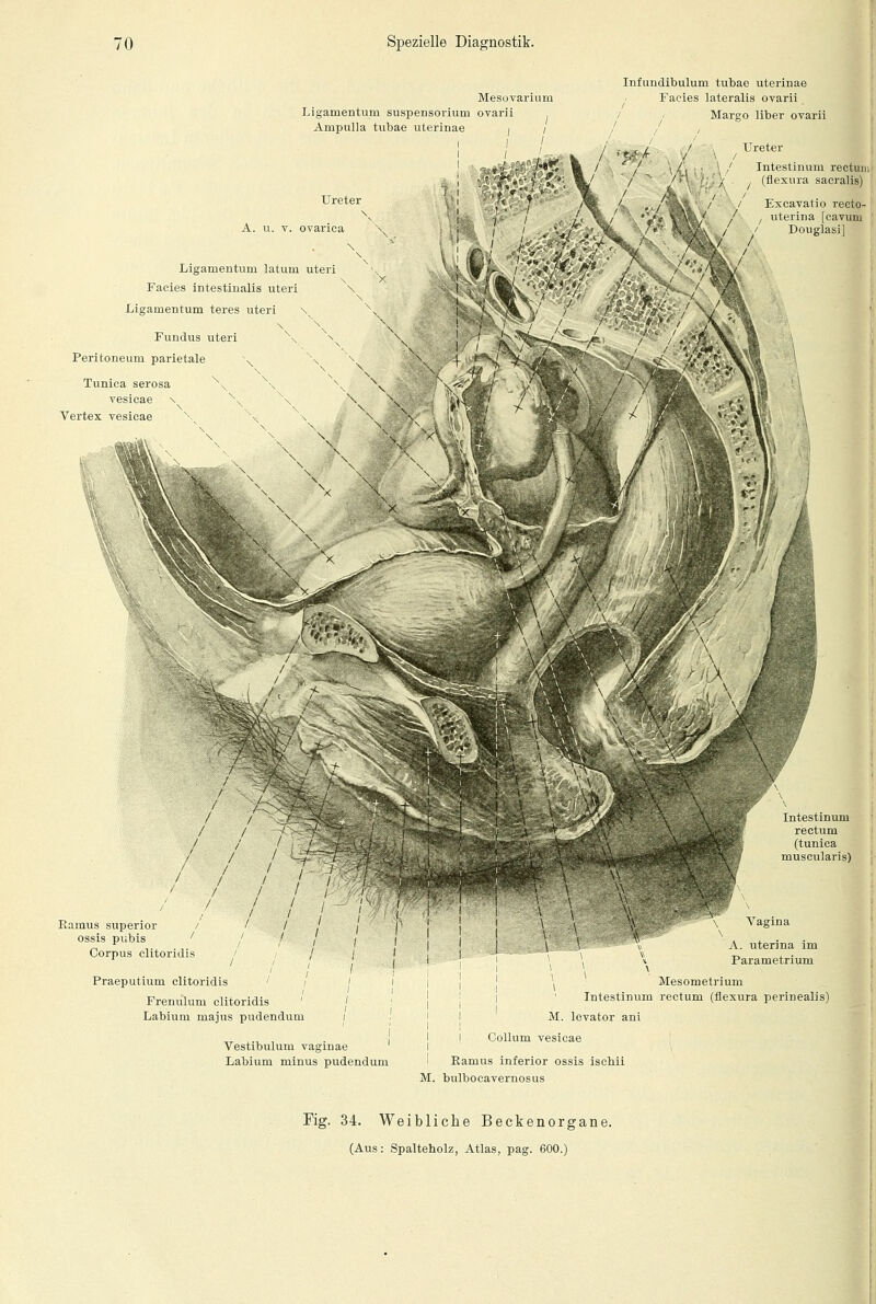 Mesovariuni Ligamentum Suspensorium ovarii Ampulla tubae uterinae i / Infundibulum tubae uterinae Facies lateralis ovarii / / / Margo liber ovarii Ureter Intestinum rectum , (flexura saeralis) Ureter A. u. v. ovarica Ligamentum latum uteri Facies intestinalis uteri Ligamentum teres uteri \ \ \ Fundus uteri Peritoneum parietale Tunica serosa vesicae \ Vertex vesicae I / / /<^i./ *«f» ¥&&/ / / uterina [cavura ■ ^HL. ' Douglasil Praeputium clitoridis Frenulum clitoridis Labium majus pudendum Vestibulum vaginae Labium minus pudendum \ Vagina A. uterina im Parametrium Mesometrium Intestinum rectum (flexura perinealis) M. levator ani I Collum vesicae Ramus inferior ossis ischii M. bulbocavernosus Fig. 34. Weibliche Beckenorgane.