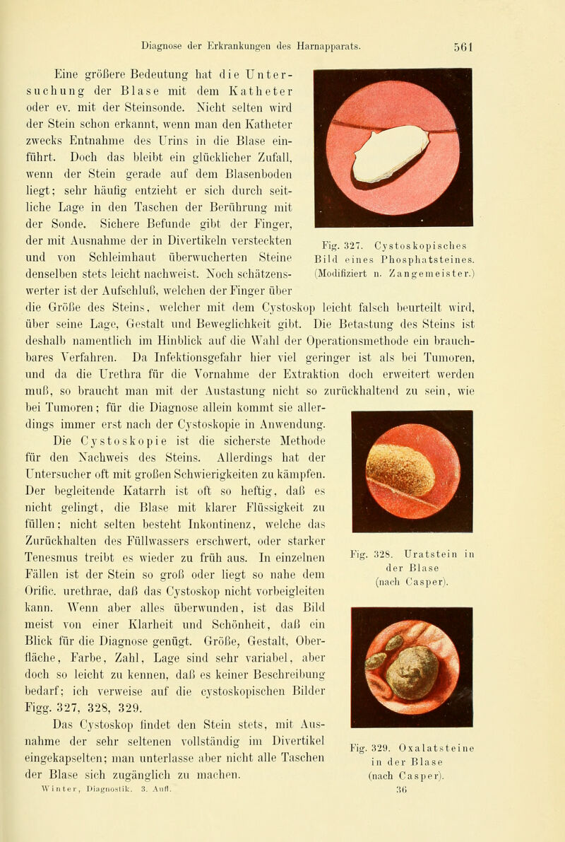Fig. 327. Cystoskopisches Bild eines Phosphatsteines. (Modifiziert n. Zange meist er.) Eine größere Bedeutung hat die Unter- suchung der Blase mit dem Katheter oder ev. mit der Steinsonde. Nicht selten wird der Stein schon erkannt, wenn man den Katheter zwecks Entnahme des Urins in die Blase ein- führt. Doch das bleibt ein glücklicher Zufall, wenn der Stein gerade auf dem Blasenboden liegt; sehr häufig entzieht er sich durch seit- liche Lage in den Taschen der Berührung mit der Sonde. Sichere Befunde gibt der Finger, der mit Ausnahme der in Divertikeln versteckten und von Schleimhaut überwucherten Steine denselben stets leicht nachweist. Noch schätzens- werter ist der Aufschluß, welchen der Finger über die Größe des Steins, welcher mit dem Cystoskop leicht falsch beurteilt wird, über seine Lage, Gestalt und Beweglichkeit gibt. Die Betastung des Steins ist deshalb namentlich im Hinblick auf die Wahl der Operationsmethode ein brauch- bares Verfahren. Da Infektionsgefahr hier viel geringer ist als bei Tumoren, und da die Urethra für die Vornahme der Extraktion doch erweitert werden muß, so braucht man mit der Austastung nicht so zurückhaltend zu sein, wie bei Tumoren; für die Diagnose allein kommt sie aller- dings immer erst nach der Cystoskopie in Anwendung. Die Cystoskopie ist die sicherste Methode für den Nachweis des Steins. Allerdings hat der Untersucher oft mit großen Schwierigkeiten zu kämpfen. Der begleitende Katarrh ist oft so heftig, daß es nicht gelingt, die Blase mit klarer Flüssigkeit zu füllen; nicht selten besteht Inkontinenz, welche das Zurückhalten des Füllwassers erschwert, oder starker Tenesmus treibt es wieder zu früh aus. In einzelnen Fällen ist der Stein so groß oder liegt so nahe dem Orific. urethrae, daß das Cystoskop nicht vorbeigleiten kann. Wenn aber alles überwunden, ist das Bild meist von einer Klarheit und Schönheit, daß ein Blick für die Diagnose genügt. Größe, Gestalt, Ober- fläche, Farbe, Zahl, Lage sind sehr variabel, aber doch so leicht zu kennen, daß es keiner Beschreibung bedarf; ich verweise auf die cystoskopischen Bilder Figg. 327, 328, 329. Das Cystoskop findet den Stein stets, mit Aus- nahme der sehr seltenen vollständig im Divertikel eingekapselten; man unterlasse aber nicht alle Taschen der Blase sich zugänglich zu machen. Fig. 328. Uratstein in der Blase (nach Casper). Fig. 329. Oxalatsteine in der Blase (nach Casper). Winter, Diagnostik. 3. Aufl. 36