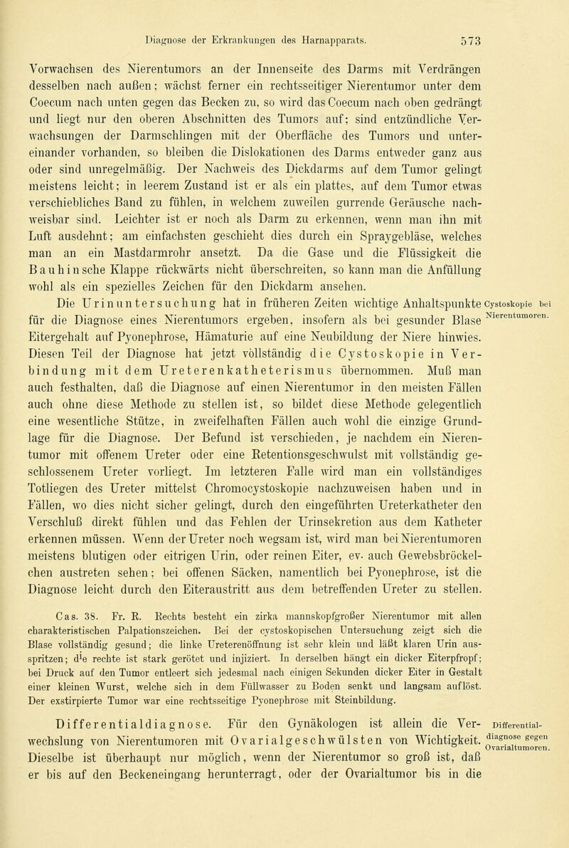 Vorwachsen des Nierentumors an der Innenseite des Darms mit Verdrängen desselben nach außen; wächst ferner ein rechtsseitiger Nierentumor unter dem Coecum nach unten gegen das Becken zu, so wird das Coecum nach oben gedrängt und liegt nur den oberen Abschnitten des Tumors auf; sind entzündliche Ver- wachsungen der Darmschlingen mit der Oberfläche des Tumors und unter- einander vorhanden, so bleiben die Dislokationen des Darms entweder ganz aus oder sind unregelmäßig. Der Nachweis des Dickdarms auf dem Tumor gelingt meistens leicht; in leerem Zustand ist er als ein plattes, auf dem Tumor etwas verschiebliches Band zu fühlen, in welchem zuweilen gurrende Geräusche nach- weisbar sind. Leichter ist er noch als Darm zu erkennen, wenn man ihn mit Luft ausdehnt; am einfachsten geschieht dies durch ein Spraygebläse, welches man an ein Mastdarmrohr ansetzt. Da die Gase und die Flüssigkeit die B a u h i n sehe Klappe rückwärts nicht überschreiten, so kann man die Anfüllung wohl als ein spezielles Zeichen für den Dickdarm ansehen. Die Urinuntersuchung hat in früheren Zeiten wichtige AnhaltspunkteCystoskopie bei für die Diagnose eines Nierentumors ergeben, insofern als bei gesunder Blase Nierentumoren- Eitergehalt auf Pyonephrose, Hämaturie auf eine Neubildung der Niere hinwies. Diesen Teil der Diagnose hat jetzt vollständig die Cystoskopie in Ver- bindung mit dem Ureterenkatheterismus übernommen. Muß man auch festhalten, daß die Diagnose auf einen Nierentumor in den meisten Fällen auch ohne diese Methode zu stellen ist, so bildet diese Methode gelegentlich eine wesentliche Stütze, in zweifelhaften Fällen auch wohl die einzige Grund- lage für die Diagnose. Der Befund ist verschieden, je nachdem ein Nieren- tumor mit offenem Ureter oder eine Retentionsgeschwulst mit vollständig ge- schlossenem Ureter vorliegt. Im letzteren Falle wird man ein vollständiges Totliegen des Ureter mittelst Chromocystoskopie nachzuweisen haben und in Fällen, wo dies nicht sicher gelingt, durch den eingeführten Ureterkatheter den Verschluß direkt fühlen und das Fehlen der Urinsekretion aus dem Katheter erkennen müssen. Wenn der Ureter noch wegsam ist, wird man bei Nierentumoren meistens blutigen oder eitrigen Urin, oder reinen Eiter, ev- auch Gewebsbröckel- chen austreten sehen; bei offenen Säcken, namentlich bei Pyonephrose, ist die Diagnose leicht durch den Eiteraustritt aus dem betreffenden Ureter zu stellen. Cas. 38. Fr. R. Rechts besteht ein zirka niannskopfgroßer Nierentumor mit allen charakteristischen Palpationszeichen. Bei der cystoskopischen Untersuchung zeigt sich die Blase vollständig gesund; die linke Ureterenöffnung ist sehr klein und läßt klaren Urin aus- spritzen; d*e rechte ist stark gerötet und injiziert. In derselben hängt ein dicker Eiterpfropf; bei Druck auf den Tumor entleert sich jedesmal nach einigen Sekunden dicker Eiter in Gestalt einer kleinen Wurst, welche sich in dem Füllwasser zu Boden senkt und langsam auflöst. Der exstirpierte Tumor war eine rechtsseitige Pyonephrose mit Steinbildung. Uifferentialdiagnose. Für den Gynäkologen ist allein die Ver- Differentiai- wechslung von Nierentumoren mit Ovarialgeschwülsten von Wichtigkeit. ^iagnonf gegen ° o a Ovarialtumoren. Dieselbe ist überhaupt nur möglich, wenn der Nierentumor so groß ist, daß er bis auf den Beckeneingang herunterragt, oder der Ovarialtumor bis in die