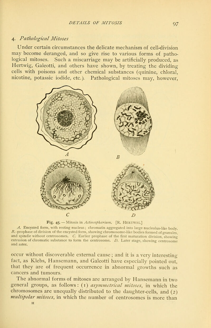 4. Pathological Mitoses Under certain circumstances the delicate mechanism of cell-division may become deranged, and so give rise to various forms of patho- logical mitoses. Such a miscarriage may be artificially produced, as Hertwig, Galeotti, and others have shown, by treating the dividing cells with poisons and other chemical substances (quinine, chloral, nicotine, potassic iodide, etc.). Pathological mitoses may, however. Fig. 45. — MMosis in Actinosp/icerium. [R. Hertwig.] A. Encysted form, with resting nucleus; chromatin aggregated into large nucleolus-like bod}'. B. prophase of division of the encysted form, showing chromosome-Hke bodies formed of crranules, and spindle without centrosomes. C. Earlier prophase of the first maturation division, showing extrusion of chromatic substance to form the centrosome. D. Later stage, showing- centrosome and aster. occur without discoverable external cause ; and it is a very interestino- fact, as Klebs, Hansemann, and Galeotti have especially pointed out, that they are of frequent occurrence in abnormal growths such as cancers and tumours. The abnormal forms of mitoses are arranged by Hansemann in two general groups, as follows: (i) asymmetrical mitoses, in which the chromosomes are unequally distributed to the daughter-cells, and (2) multipolar mitoses, in which the number of centrosomes is more than