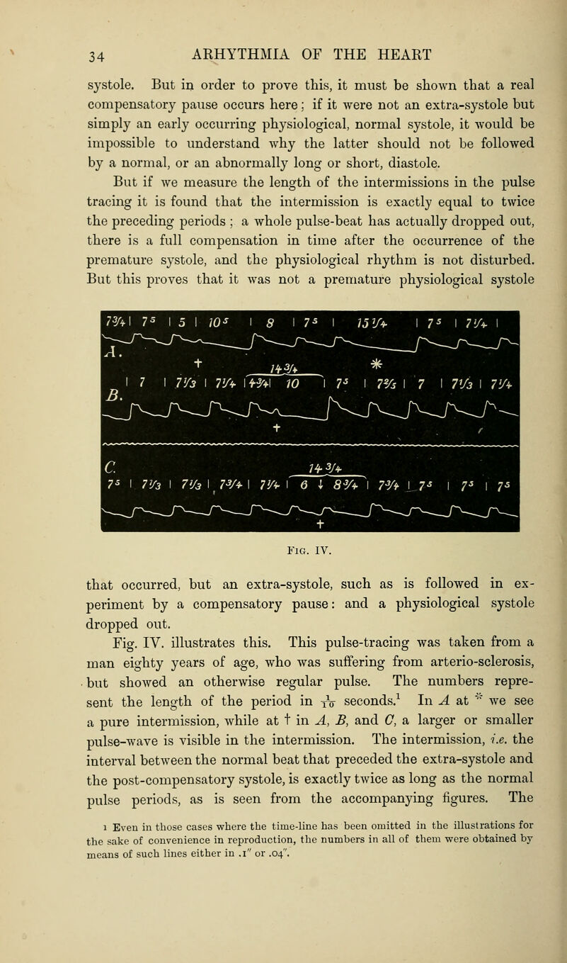 systole. But in order to prove this, it must be shown that a real compensatory pause occurs here; if it were not an extra-systole but simply an early occurring physiological, normal systole, it would be impossible to understand why the latter should not be followed by a normal, or an abnormally long or short, diastole. But if we measure the length of the intermissions in the pulse tracing it is found that the intermission is exactly equal to twice the preceding periods ; a whole pulse-beat has actually dropped out, there is a full compensation in time after the occurrence of the premature systole, and the physiological rhythm is not disturbed. But this proves that it was not a premature physiological systole Fig. IV. that occurred, but an extra-systole, such as is followed in ex- periment by a compensatory pause: and a physiological systole dropped out. Fig. IV. illustrates this. This pulse-tracing was taken from a man eighty years of age, who was suffering from arterio-sclerosis, but showed an otherwise regular pulse. The numbers repre- sent the length of the period in yV seconds.^ In A at ' we see a pure intermission, while at t in A, B, and G, a larger or smaller pulse-wave is visible in the intermission. The intermission, i.e. the interval between the normal beat that preceded the extra-systole and the post-compensatory systole, is exactly twice as long as the normal pulse periods, as is seen from the accompanying figures. The 1 Even in those cases where the time-line has been omitted in the illustrations for the sake of convenience in reproduction, the numbers in all of them were obtained by means of such lines either in .i or .04.