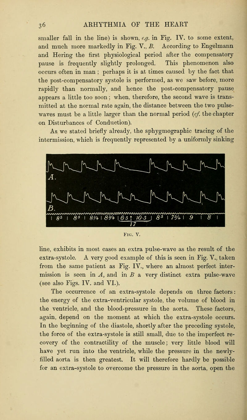 smaller fall in the line) is shown, e.g. in Fig. IV. to some extent, and much more markedly in Fig, V., B. According to Engelmann and Hering the first physiological period after the compensatory pause is frequently slightly prolonged. This phenomenon also occurs often in man ; perhaps it is at times caused by the fact that the post-compensatory systole is performed, as we saw before, more rapidly than normally, and hence the post-compensatory pause appears a little too soon; Avhen, therefore, the second wave is trans- mitted at the normal rate again, the distance between the two pulse- waves must be a little larger than the normal period (c/. the chapter on Disturbances of Conduction). As we stated briefly already, the sphygmographic tracing of the intermission, which is frequently represented by a uniformly sinking A. B. .<Vvv\A/\A^'>AAAAnA/VVV>AyVV\AAAA<>A/\AA/VVA/W\A/\/V\AAA/\A^ ■■■ 1 85 1 s^ \ 8!/i- 1 8V4- 1 65 t 10-5 \ 8^ \ 7^/^ \ 9 \ 8 \ Fig. V. line, exhibits in most cases an extra pulse-wave as the result of the extra-systole. A very good example of this is seen in Fig. V., taken from the same patient as Fig. IV., where an almost perfect inter- mission is seen in A, and in B sl very distinct extra pulse-wave (see also Figs. IV. and VL). The occurrence of an extra-systole depends on three factors: the energy of the extra-ventricular systole, the volume of blood in the ventricle, and the blood-pressure in the aorta. These factors, again, depend on the moment at which the extra-systole occurs. In the beginning of the diastole, shortly after the preceding systole, the force of the extra-systole is still small, due to the imperfect re- covery of the contractility of the muscle; very little blood will have yet run into the ventricle, while the pressure in the newly- filled aorta is then greatest. It will therefore hardly be possible for an extra-systole to overcome the pressure in the aorta, open the