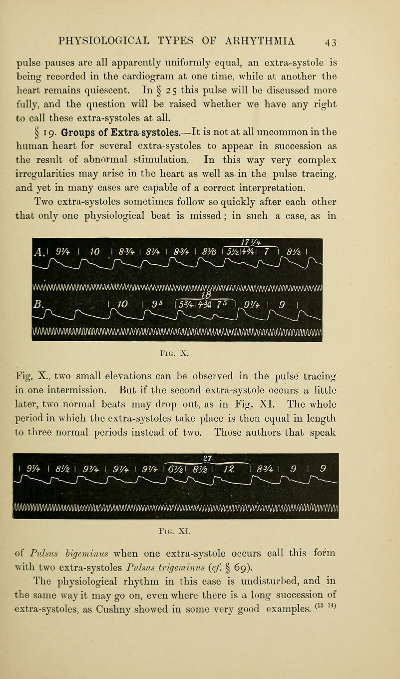 pulse pauses are all apparently uniformly equal, an extra-systole is beino- recorded in the cardios^ram at one time, Avhile at another the heart remains quiescent. In ^ 25 this pulse will be discussed more fully, and the question will be raised whether we have any right to call these extra-systoles at all. ^19. Groups of Extra-systoles.—It is not at all uncommon in the human heart for several extra-systoles to appear in succession as the result of abnormal stimulation. In this way very complex irregularities may arise in the heart as well as in the pulse tracing, and yet in many cases are capable of a correct interpretation. Two extra-systoles sometimes follow so quickly after each other that only one physiological beat is missed; in such a case, as in A\ 9Vi- I W I 8¥¥ I 8'A I S¥i- I SVe fs^zimi 7 I Si/z 73 L \ W 1 55 \53A\f^4\ 7-5 \9V^ I . , Fig. X. rig. X., two small elevations can be observed in the pulse tracing in one intermission. But if the second extra-systole occurs a little later, two normal beats may drop out, as in Fig. XI. The whole period in which the extra-systoles take place is then equal in length to three normal periods instead of two. Those authors that speak Fig. XI. of Pulsus higeminus when one extra-systole occurs call this form with two extra-systoles Pulsus trigeminus (cf. § 69). The physiological rhythm in this case is undisturbed, and in the same way it may go on, even where there is a long succession of extra-systoles, as Cushny showed in some very good examples. ^^^ ^^^