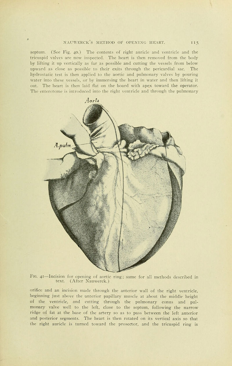 septum. (See Fig. 40.) The contents of right auricle and ventricle and the tricuspid valves are now inspected. The heart is then removed from the body by lifting it up vertically as far as possible and cutting the vessels from below upward as close as possible to their exits through the pericardial sac. The hydrostatic test is then applied to the aortic and pulmonary valves by pouring water into these vessels, or by immersing the heart an water and then, lifting it out. The heart is then laid flat on the board with apex toward the operator. The enterotome is introduced into the right ventricle and through the pulmonary Aorta Fig. 41—Incision for opening of aortic ring; same for all methods described in text. (After Nauwerck.) orifice and an incision made through the anterior wall of the right' ventricle, beginning just above the -anterior papillary muscle at about the middle height of the ventricle, and cutting through the pulmonary conus and pul- monary valve well to the left, close to the septum, following the narrow ridge of fat at the base of the artery so as to pass between the left anterior and posterior segments. The heart is then rotated on its vertical axis so that the right auricle is turned toward the prosector, and the tricuspid ring is
