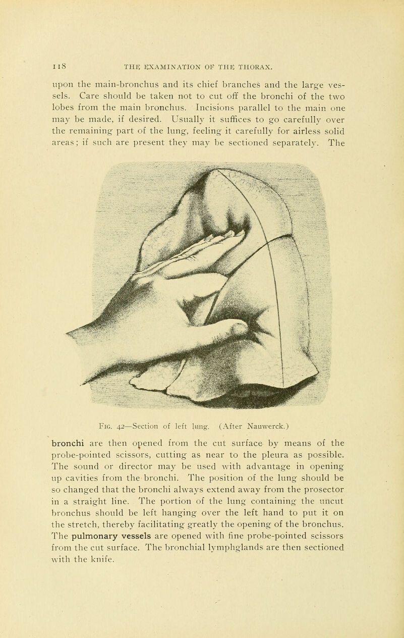 upon the main-bronchus and its chief branches and the large ves- sels. Care should be taken not to cut off the bronchi of the two lobes from the main bronchus. Incisions parallel to the main one may be made, if desired. Usually it suffices to go carefully over the remaining part of the lung, feeling it carefully for airless solid areas; if such are present they may be sectioned separately. The <f Fig. 42—Section of left lung. (After Nauwerck.) bronchi are then opened from the cut surface by means of the probe-pointed scissors, cutting as near to the pleura as possible. The sound or director may be used with advantage in opening up cavities from the bronchi. The position of the lung should be so changed that the bronchi always extend away from the prosector in a straight line. The portion of the lung containing the uncut bronchus should be left hanging over the left hand to put it on the stretch, thereby facilitating greatly the opening of the bronchus. The pulmonary vessels are opened with fine probe-pointed scissors from the cut surface. The bronchial lymphglands are then sectioned with the knife.