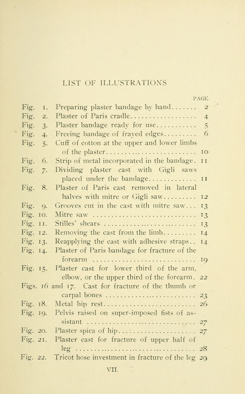 LIST OF ILLUSTRATIONS PAGE Fig. I. Preparing plaster bandage by hand 2 Fig. 2. Plaster of Paris cradle 4 Fig. 3. Plaster bandage ready for use 5 Fig. 4. Freeing bandage of frayed edges 6 Fig. 5. Cuff of cotton at the upper and lower limbs of the plaster 10 Fig. 6. Strip of metal incorporated in the bandage. 11 Fig. 7. Dividing plaster cast with Gigli saws placed under the bandage 11 Fig. 8. Plaster of Paris cast removed in lateral halves with mitre or Gigli saw 12 Fig. 9. Grooves cut in the cast with mitre saw. . . 13 Fig. 10. Mitre saw 13 Fig. 11. Stilles' shears 13 Fig. 12. Removing the cast from the limb 14 Fig. 13. Reapplying the cast with adhesive straps. . 14 Fig. 14. Plaster of Paris bandage for fracture of the forearm 19 Fig. 15. Plaster cast for lower third of the arm. elbow, or the upper third of the forearm. 22 Figs. 16 and 17. Cast for fracture of the thumb or carpal bones 23 Fig. 18. Metal hip rest 26 Fig. 19. Pelvis raised on super-imposed fists of as- sistant 27 Fig. 20. Plaster spica of hip 2y Fig. 21. Plaster cast for fracture of upper half of leg 2S Fig. 22. Tricot hose investment in fracture of the leg 29