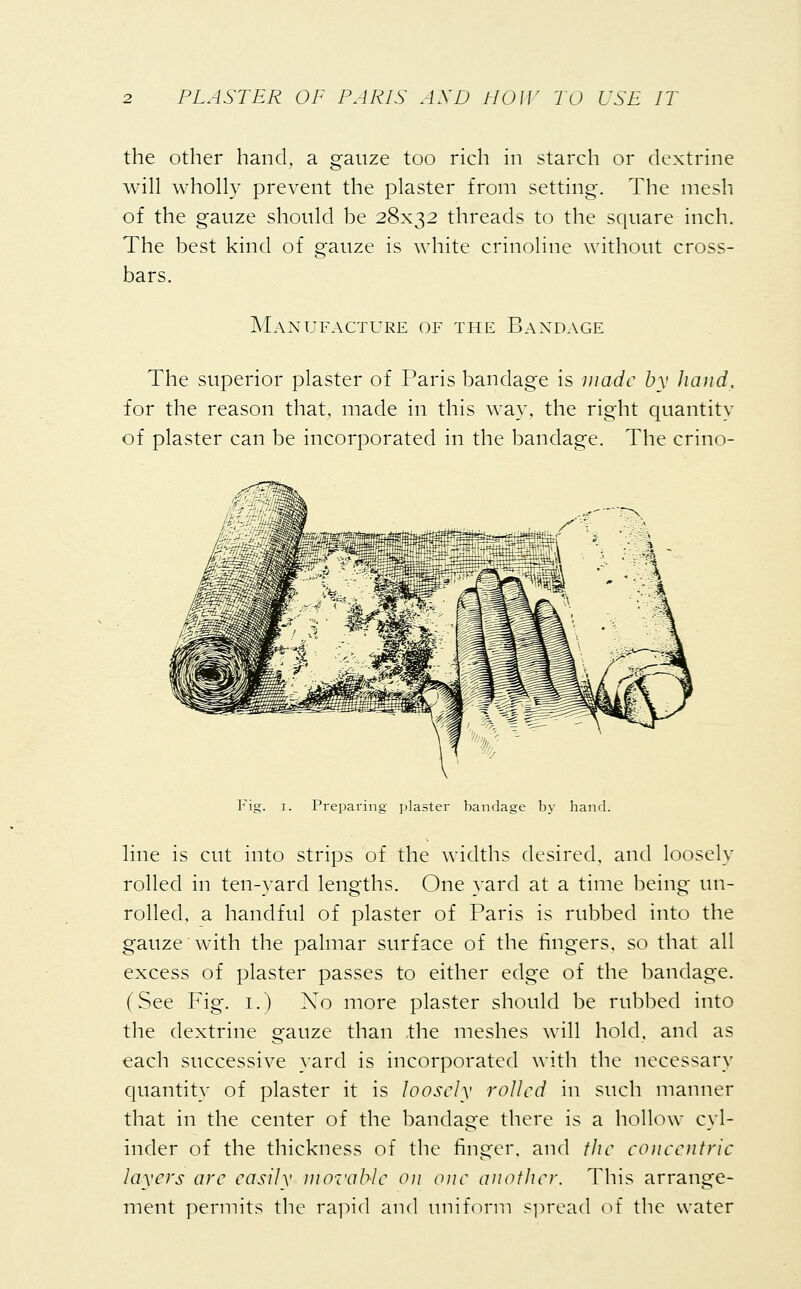 the other hand, a gauze too rich in starch or dextrine will wholly prevent the plaster from setting. The mesh of the gauze should be 28x32 threads to the square inch. The best kind of gauze is white crinoline without cross- bars. Manufacture of the Bandage The superior plaster of Paris bandage is made by hand, for the reason that, made in this way, the right quantity of plaster can be incorporated in the bandage. The crino- Fig. 1. Preparing plaster bandage by hand. line is cut into strips of the widths desired, and loosely rolled in ten-yard lengths. One yard at a time being un- rolled, a handful of plaster of Paris is rubbed into the gauze with the palmar surface of the fingers, so that all excess of plaster passes to either edge of the bandage. (See Fig. 1.) Xo more plaster should be rubbed into the dextrine gauze than the meshes will hold, and as each successive yard is incorporated with the necessary quantity of plaster it is loosely rolled in such manner that in the center of the bandage there is a hollow cyl- inder of the thickness of the finger, and the concentric layers are easily movable on one another. This arrange- ment permits the rapid and uniform spread of the water