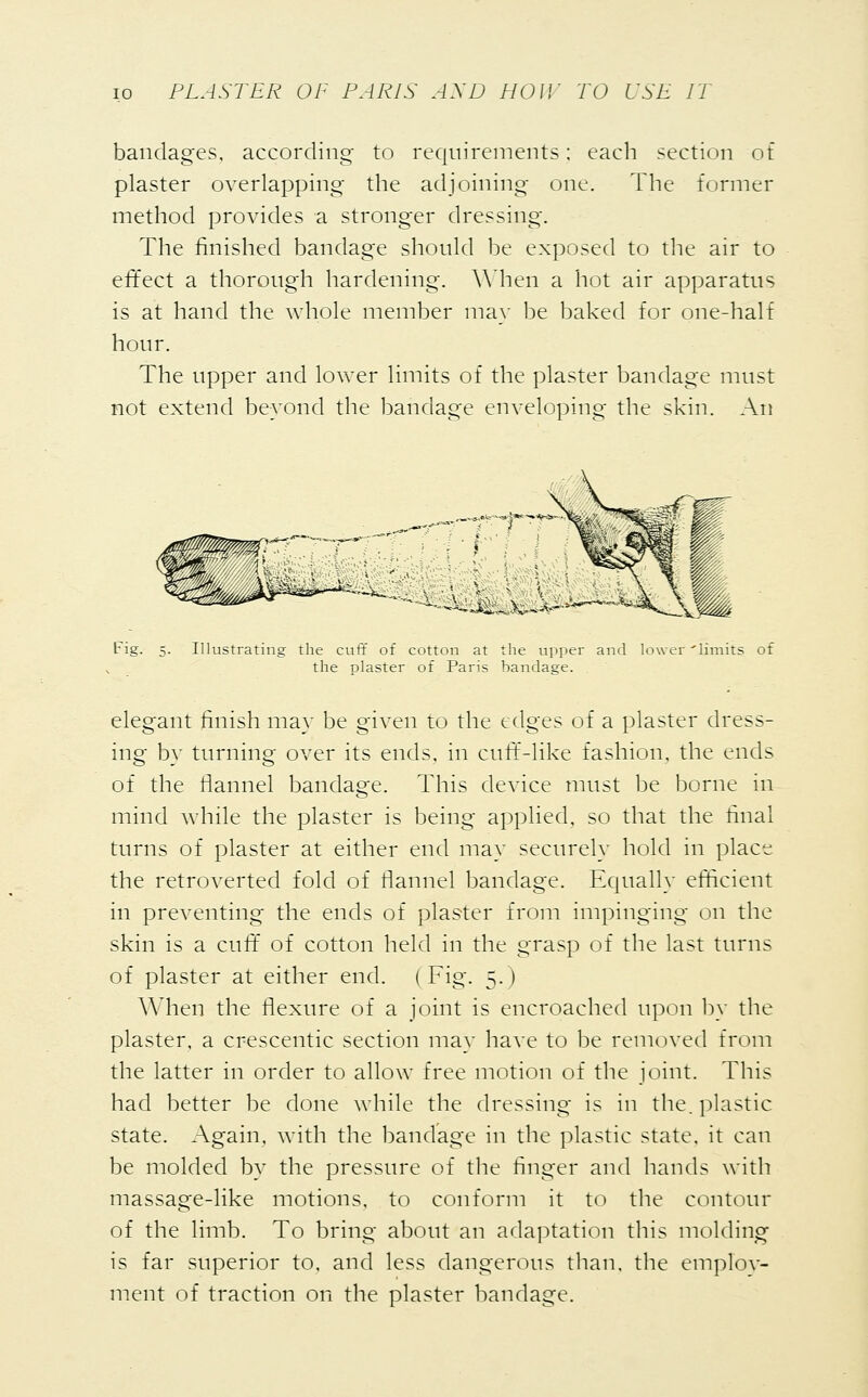 bandages, according to requirements; each section of plaster overlapping the adjoining one. The former method provides a stronger dressing. The finished bandage should be exposed to the air to effect a thorough hardening. When a hot air apparatus is at hand the whole member may be baked for one-half hour. The upper and lower limits of the plaster bandage must not extend beyond the bandage enveloping the skin. An Fig. 5. Illustrating the cuff of cotton at the upper and lower 'limits of the plaster of Paris bandage. elegant finish may be given to the edges of a plaster dress- ing by turning over its ends, in cuff-like fashion, the ends of the flannel bandage. This device must be borne in mind while the plaster is being applied, so that the final turns of plaster at either end may securely hold in place the retroverted fold of flannel bandage. Equally efficient in preventing the ends of plaster from impinging on the skin is a cuff of cotton held in the grasp of the last turns of plaster at either end. (Fig. 5. I When the flexure of a joint is encroached upon by the plaster, a crescentic section may have to be removed from the latter in order to allow free motion of the joint. This had better be done while the dressing is in the. plastic state. Again, with the bandage in the plastic state, it can be molded by the pressure of the finger and hands with massage-like motions, to conform it to the contour of the limb. To bring about an adaptation this molding is far superior to, and less dangerous than, the employ- ment of traction on the plaster bandage.