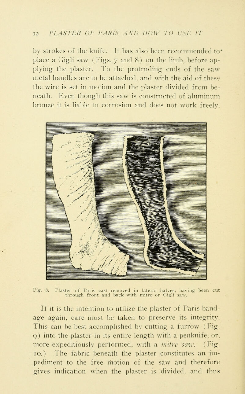 by strokes of the knife. It has also been recommended to' place a Gigli saw (Figs. 7 and 8) on the limb, before ap- plying the plaster. To the protruding ends of the saw metal handles are to be attached, and with the aid of these the wire is set in motion and the plaster divided from be- neath. Even though this saw is constructed of aluminum bronze it is liable to corrosion and does not work freely. Fig. S. Plaster of Paris cast removed in lateral halves, having been cut through front and back with mitre or Gigli saw. If it is the intention to utilize the plaster of Paris band- age again, care must be taken to preserve its integrity. This can be best accomplished by cutting a furrow ( Fig. 9) into the plaster in its entire length with a penknife, or, more expeditiously performed, with a mitre saw. ( Fig. 10.) The fabric beneath the plaster constitutes an im- pediment to the free motion of the saw and therefore gives indication when the plaster is divided, and thus