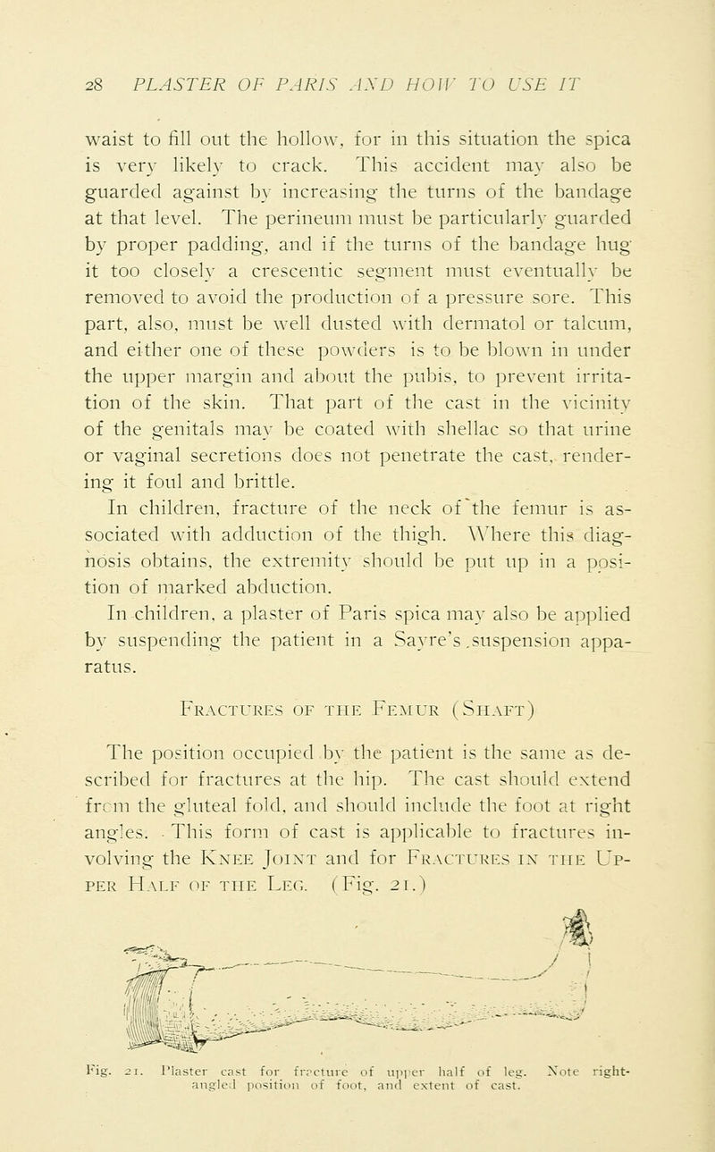 waist to fill out the hollow, for in this situation the spica is very likely to crack. This accident may also be guarded against by increasing the turns of the bandage at that level. The perineum must be particularly guarded by proper padding, and if the turns of the bandage hug- it too closely a crescentic segment must eventually be removed to avoid the production of a pressure sore. This part, also, must be well dusted with dermatol or talcum, and either one of these powders is to be blown in under the upper margin and about the pubis, to prevent irrita- tion of the skin. That part of the cast in the vicinity of the genitals may be coated with shellac so that urine or vaginal secretions does not penetrate the cast, render- ing it foul and brittle. In children, fracture of the neck of The femur is as- sociated with adduction of the thigh. Where this diag- nosis obtains, the extremity should be put up in a posi- tion of marked abduction. In children, a plaster of Paris spica may also be applied by suspending the patient in a Sayre's .suspension appa- ratus. Fractures of the Femur (Shaft) The position occupied by the patient is the same as de- scribed for fractures at the hip. The cast should extend frcm the gluteal fold, and should include the foot at right angles. ■ This form of cast is applicable to fractures in- volving the Knee Joint and for Fractures ix the Up- per Half of the Leg. (Fie. 21.) / 1 1 Fig. 21. Plaster cast for frpcture of upper half of leg. Note angle 1 position of foot, and extent of cast.