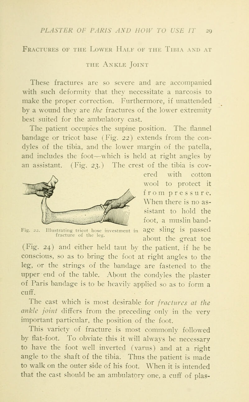 Fractures of the Lower Half of the Tibia and at the Ax kle Joint These fractures are so severe and are accompanied with such deformity that they necessitate a narcosis to make the proper correction. Furthermore, if unattended by a wound they are the fractures of the lower extremity best suited for the ambulatory cast. The patient occupies the supine position. The flannel bandage or tricot base (Fig. 22) extends from the con- dyles of the tibia, and the lower margin of the patella, and includes the foot-^which is held at right angles by an assistant. (Fig. 23.) The crest of the tibia is cov- ered with cotton wool to protect it from pressure. When there is no as- sistant to hold the foot, a muslin band- age sling is passed about the great toe ;. 24) and either held taut by the patient, if he be conscious, so as to bring the foot at right angles to the leg, or the strings of the bandage are fastened to the upper end of the table. About the condyles the plaster of Paris bandage is to be heavily applied so as to form a cuff. The cast which is most desirable for fractures at the ankle joint differs from the preceding only in the very important particular, the position of the foot. This variety of fracture is most commonly followed by flat-foot. To obviate this it will always be necessary to have the foot well inverted (varus) and at a right angle to the shaft of the tibia. Thus the patient is made to walk on the outer side of his foot. When it is intended that the cast should be an ambulatory one. a cuff of plas- fracture ot the lea;. (Fi<