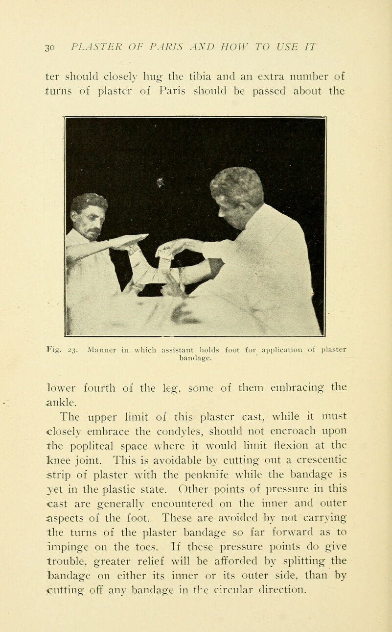 ter should closely hug the tibia and an extra number of turns of plaster of Paris should be passed about the Fig. 23. Manner which assistant holds foot for application of plaster bandage. lower fourth of the leg, some of them embracing the ankle. The upper limit of this plaster cast, while it must closely embrace the condyles, should not encroach upon the popliteal space where it would limit flexion at the knee joint. This is avoidable by cutting out a crescentic strip of plaster with the penknife while the bandage is yet in the plastic state. Other points of pressure in this cast are generally encountered on the inner and outer aspects of the foot. These are avoided by not carrying the turns of the plaster bandage so far forward as to impinge on the toes. If these pressure points do give trouble, greater relief will be afforded by splitting the bandage on either its inner or its outer side, than by cutting off any bandage in the circular direction.