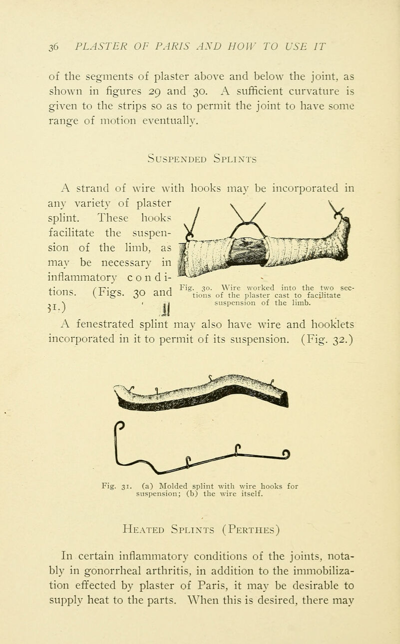 of the segments of plaster above and below the joint, as shown in figures 29 and 30. A sufficient curvature is given to the strips so as to permit the joint to have some range of motion eventually. Suspended Splints A strand of wire with hooks may be incorporated in any variety of plaster splint. These hooks facilitate the suspen- sion of the limb, as may be necessary in inflammatory c o n d i- tions. (Figs. 30 and A fenestrated splint may also have wire and hooklets incorporated in it to permit of its suspension. (Fig. 32.) Fig. 30. Wire worked into the two sec- tions of the plaster cast to facilitate suspension of the limb. 31. (a) Molded splint with wire hooks for suspension; (b) the wire itself. Heated Splints (Perthes) In certain inflammatory conditions of the joints, nota- bly in gonorrheal arthritis, in addition to the immobiliza- tion effected by plaster of Paris, it may be desirable to supply heat to the parts. When this is desired, there may