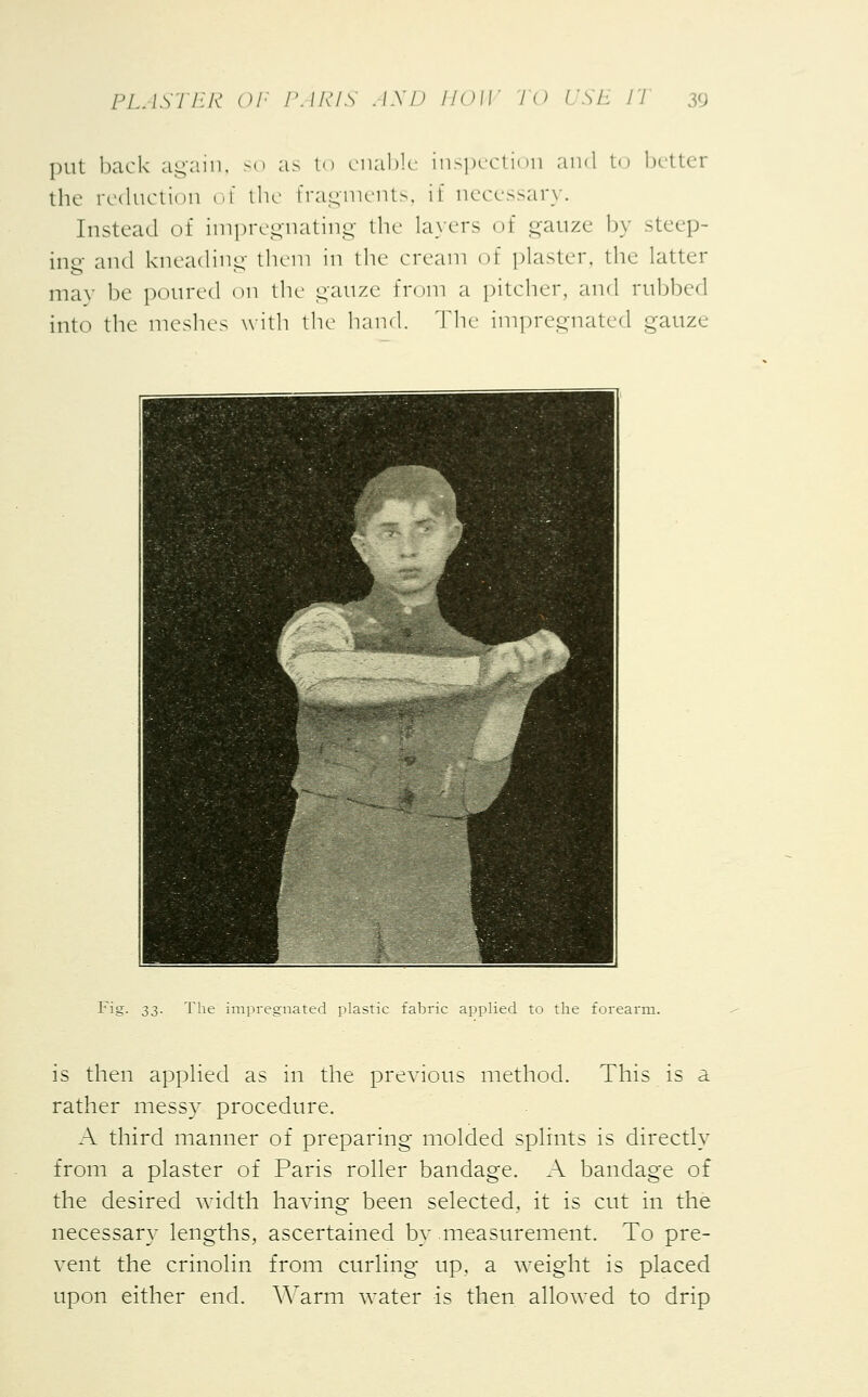 put back again, so as to enable inspection and to better the reduction of the fragments, if necessary. Instead of impregnating the layers of gauze by steep- ing and kneading them in the cream of plaster, the latter m;i\ be poured on the gauze from a pitcher, and rubbed into the meshes with the hand. The impregnated gauze Fig. 33. The impregnated plastic fabric applied to the forearm. is then applied as in the previous method. This is a rather messy procedure. A third manner of preparing molded splints is directly from a plaster of Paris roller bandage. A bandage of the desired width having been selected, it is cut in the necessary lengths, ascertained by measurement. To pre- vent the crinolin from curling up, a weight is placed upon either end. Warm water is then allowed to drip