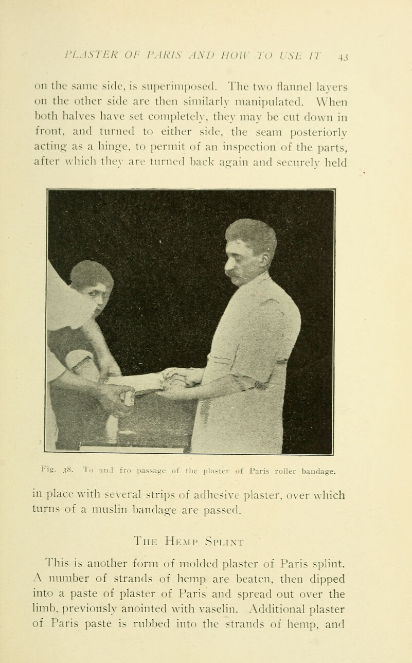 • in the same side, is superimposed. The two flannel layers on the other side are then similarly manipulated. When both halves have set completely, they may be cut down in front, and turned to either side, the seam posteriorly acting as a hinge, to permit of an inspection of the parts, after which thev are turned back again and securely held Fig. 38. To and fro passage of the if Paris roller bandage. in place with several strips of adhesive plaster, over which turns of a muslin bandage are passed. The Hemp Splint This is another form of molded plaster of Paris splint. A number of strands of hemp are beaten, then dipped into a paste of plaster of Paris and spread out over the limb, previously anointed with vaselin. Additional plaster of Paris paste is rubbed into the strands of hemp, and