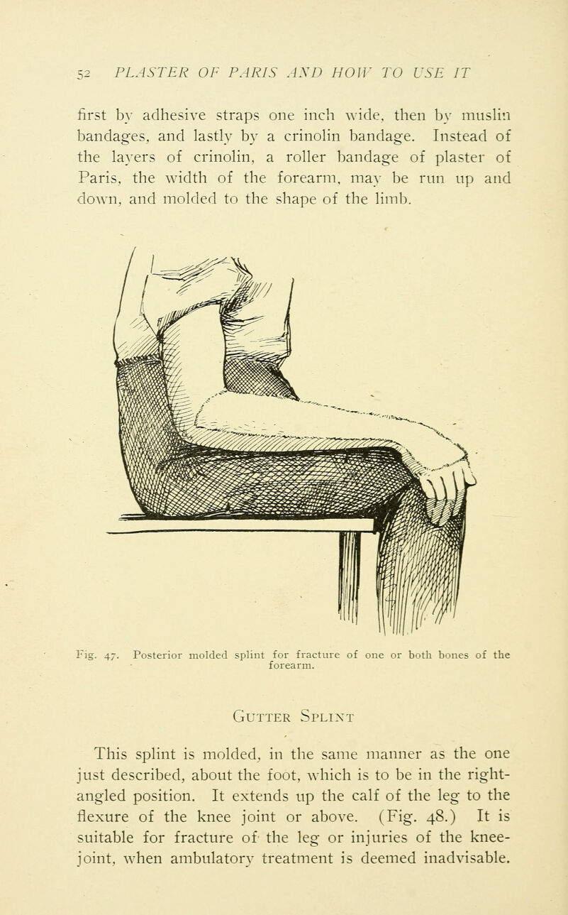 first by adhesive straps one inch wide, then by muslin bandages, and lastly by a crinolin bandage. Instead of the layers of crinolin, a roller bandage of plaster of Paris,, the width of the forearm, may be run up and down, and molded to the shape of the limb. Fig. 47. Posterior molded splint for fracture of one or both bones of the forearm. Gutter Splint This splint is molded, in the same manner as the one just described, about the foot, which is to be in the right- angled position. It extends up the calf of the leg to the flexure of the knee joint or above. (Fig. 48.) It is suitable for fracture of the leg or injuries of the knee- joint, when ambulatory treatment is deemed inadvisable.