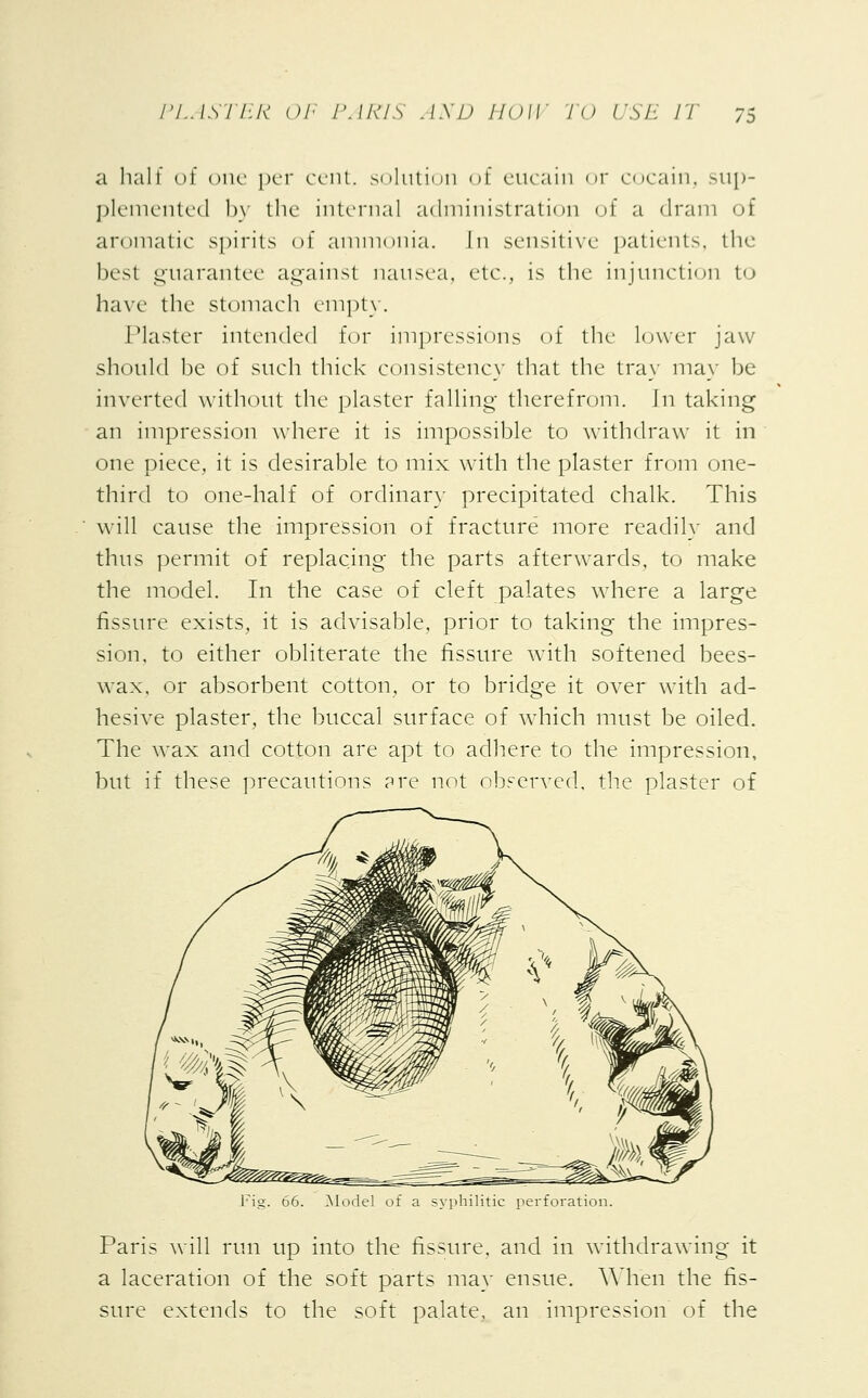 a halt of one per cent, solution oi eucain or cocain, sup- plemented by the interna] administration of a dram of aromatic spirits of ammonia. In sensitive patients, the best guarantee against nausea, etc., is the injunction to have the stomach empty. Plaster intended for impressions of the lower jaw should be of such thick consistency that the tray may be inverted without the plaster falling therefrom. In taking an impression where it is impossible to withdraw it in one piece, it is desirable to mix with the plaster from one- third to one-half of ordinary precipitated chalk. This will cause the impression of fracture more readily and thus permit of replacing the parts afterwards, to make the model. In the case of cleft palates where a large fissure exists, it is advisable, prior to taking the impres- sion, to either obliterate the fissure with softened bees- wax, or absorbent cotton, or to bridge it over with ad- hesive plaster, the buccal surface of which must be oiled. The wax and cotton are apt to adhere to the impression, but if these precautions pre not observed, the plaster of tic perforation. Paris will run up into the fissure, and in withdrawing it a laceration of the soft parts may ensue. When the fis- sure extends to the soft palate, an impression of the