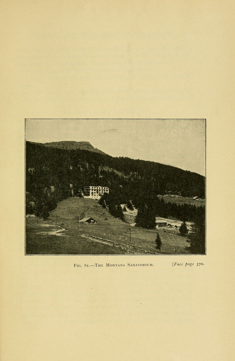 Fig. 8i.—The Montana Sanatorium. [Face page 370.