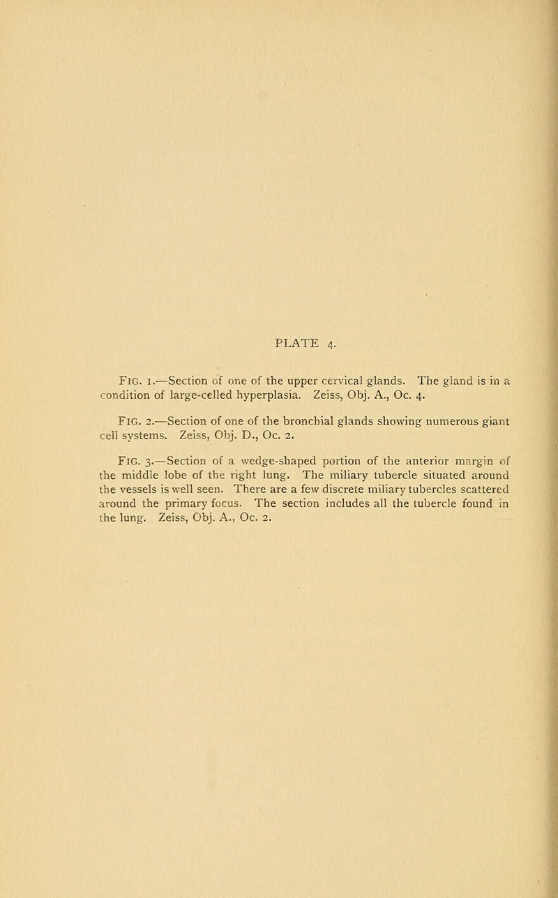 PLATE 4. Fig. I.—Section of one of the upper cervical glands. The gland is in a condition of large-celled hyperplasia. Zeiss, Obj. A., Oc. 4. Fig. 2.—Section of one of the bronchial glands showing numerous giant cell systems. Zeiss, Obj. D., Oc. 2. Fig. 3.—Section of a wedge-shaped portion of the anterior margin of the middle lobe of the right lung. The miliary tubercle situated around the vessels is well seen. There are a few discrete miliary tubercles scattered around the primary focus. The section includes all the tubercle found in the lung. Zeiss, Obj. A., Oc. 2,
