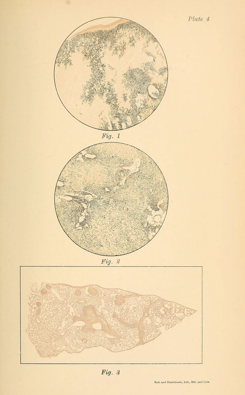 ''Mm. F*^. 5 Bale aud Danielsson, Ltd., Del. and Lith.