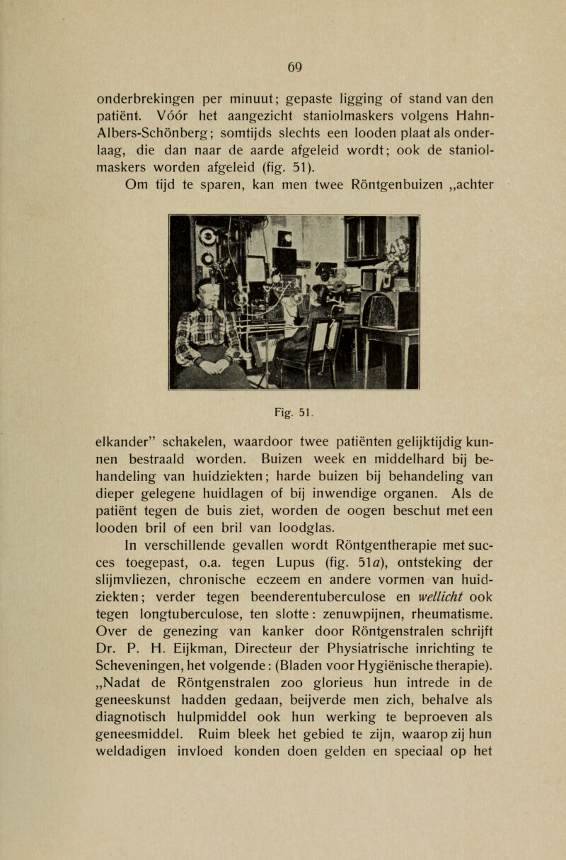 onderbrekingen per minuut; gepaste ligging of stand van den patiënt. Vóór het aangezicht staniolmaskers volgens Hahn- Albers-Schönberg; somtijds slechts een looden plaat als onder- laag, die dan naar de aarde afgeleid wordt; ook de staniol- maskers worden afgeleid (fig. 51). Om tijd te sparen, kan men twee Röntgenbuizen ,,achter Fig. 51. elkander schakelen, waardoor twee patiënten gelijktijdig kun- nen bestraald worden. Buizen week en middelhard bij be- handeling van huidziekten; harde buizen bij behandeling van dieper gelegene huidlagen of bij inwendige organen. Als de patiënt tegen de buis ziet, worden de oogen beschut met een looden bril of een bril van loodglas. In verschillende gevallen wordt Röntgentherapie met suc- ces toegepast, o.a. tegen Lupus (fig. 51 a), ontsteking der slijmvliezen, chronische eczeem en andere vormen van huid- ziekten ; verder tegen beenderentuberculose en wellicht ook tegen longtuberculose, ten slotte : zenuwpijnen, rheumatisme. Over de genezing van kanker door Röntgenstralen schrijft Dr. P. H. Eijkman, Directeur der Physiatrische inrichting te Scheveningen, het volgende: (Bladen voor Hygiënische therapie). „Nadat de Röntgenstralen zoo glorieus hun intrede in de geneeskunst hadden gedaan, beijverde men zich, behalve als diagnotisch hulpmiddel ook hun werking te beproeven als geneesmiddel. Ruim bleek het gebied te zijn, waarop zij hun weldadigen invloed konden doen gelden en speciaal op het