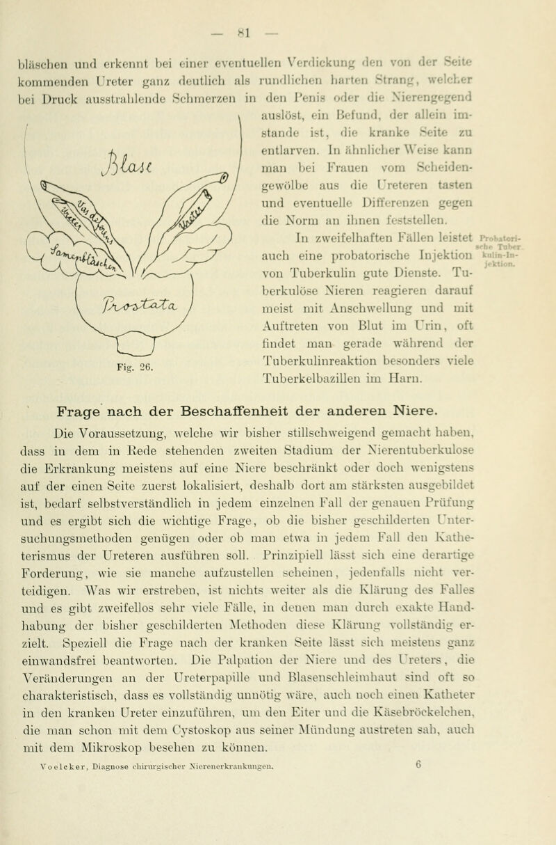 Wäschen and erkenni bei einer eventuellen Verdickung kommenden Ureter ganz deutlich als rundlichen hart bei Druck ausstrahlend' r/.en in «Ion Penis oder die Nierenj auslöst, ein Befund, <hr allein im- stande ist, «li<- krankt - zu entlarven. In ähnlicher Weise kann man bei Frauen vom Bchei gewölbe aus die I und eventuelle Differenzen gegen die Norm an ihnen festste] ■ In zweifelhaften Fällen auch eine probatorische Injektion von Tuberkulin gute Dienste. Tu- berkulös« • Mieren reagieren darauf 111«-ist mit Anschwellung und mit Auftreten von Blut im Urin, oft findet man gerade während der Tuberkulinreaktion besonders viele Tuberkelbazillen im Harn. Prohatori- knlin-In- Fig. 26. Frage nach der Beschaffenheit der anderen Niere. Die Voraussetzung, welche wir bisher stillschweigend gemacht haben, dass in dem in Rede stehenden zweiten Stadium der Nierentuberkulose die Erkrankung meistens auf eine Niere beschränkt oder doch wenigstens auf der einen Seite zuerst lokalisiert, deshalb dort am stärksten ausgebildet ist, bedarf selbstverständlich in jedem einzelnen Fall der genauen Prüfung und es ergibt sich die wichtige Frage, ob die bisher geschilderten Unter- suchungsmethoden genügen oder ob man etwa in jedem Fall den Kathe- terismus der Ureteren ausführen soll. Prinzipiell lässt sieh eine derartige Forderung, wie sie manche aufzustellen seheinen, jedenfalls nicht \ teidigen. Was wir erstreben, ist nichts weiter als die Klärung des Falles und es gibt zweifellos sehr viele Fälle, in denen man durch exakte Hand- habung der bisher geschilderten Methoden diese Klärung vollständig er- zielt. Speziell die Frage nach der kranken Seite lässt sich meistens ganz einwandsfrei beantworten. Die Palpation der Niere und des Ureters, die Veränderungen an der Ureterpapüle und Blasenschleimhaut sind oft so charakteristisch, dass es vollständig unnötig wäre, auch noch einen Katheter in den kranken Ureter einzuführen, um den Eiter und die Käsebröckelchen, die man schon mit dem Cystoskop aus seiner Mündung austreten sah, auch mit dem Mikroskop besehen zu können. Voelcker. Diagnose chirurgischer Nierenerkrantungeii.