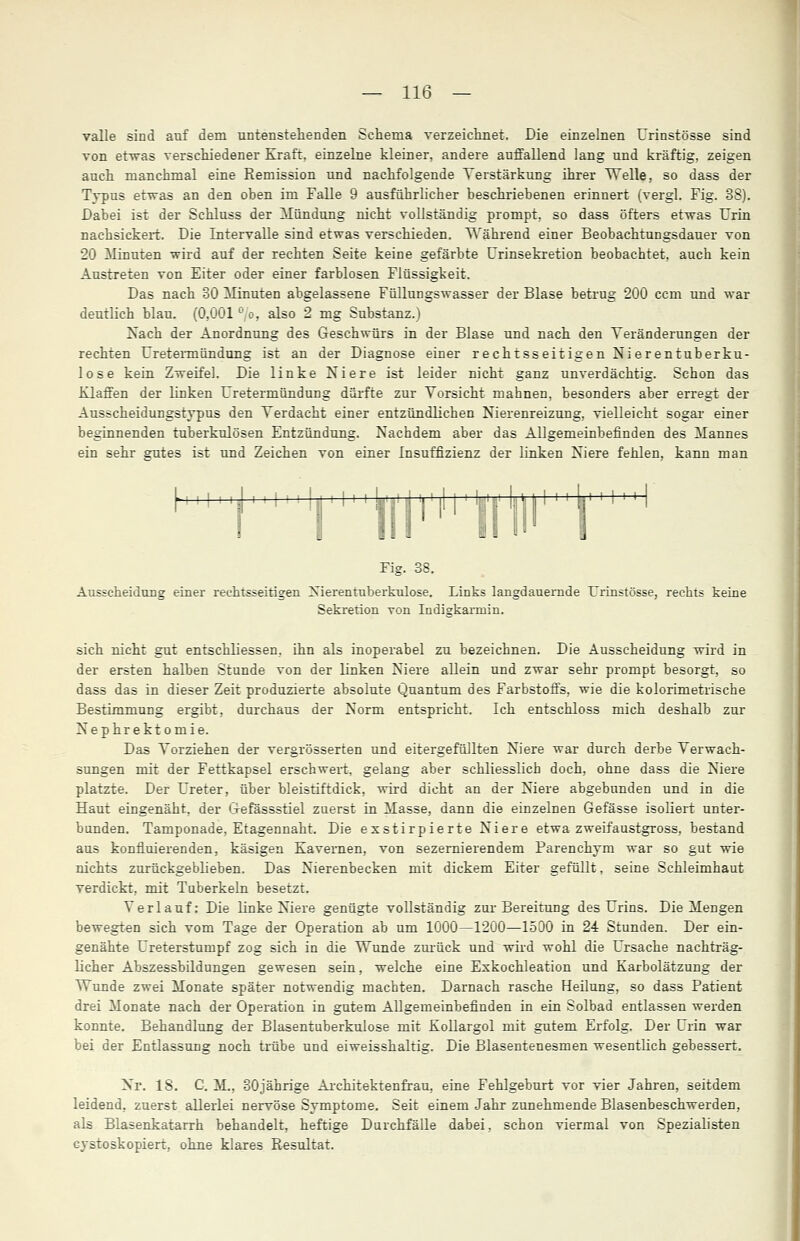 valle sind auf dem untenstehenden Schema verzeichnet. Die einzelnen Urinstösse sind von etwas verschiedener Kraft, einzelne kleiner, andere auffallend lang und kräftig, zeigen auch manchmal eine Remission und nachfolgende Verstärkung ihrer Welle, so dass der Typus etwas an den oben im Falle 9 ausführlicher beschriebenen erinnert (vergl. Fig. 38). Dabei ist der Schluss der Mündung nicht vollständig prompt, so dass öfters etwas Urin nachsickert. Die Intervalle sind etwas verschieden. Während einer Beobachtungsdauer von 20 Minuten -wird auf der rechten Seite keine gefärbte Urinsekretion beobachtet, auch kein Austreten von Eiter oder einer farblosen Flüssigkeit. Das nach 30 Minuten abgelassene Füllungswasser der Blase betrug 200 ccm und war deutlich blau. (0,001 ° o, also 2 mg Substanz.) Nach der Anordnung des Geschwürs in der Blase und nach den Veränderungen der rechten Uretermündung ist an der Diagnose einer rechtsseitigen Nierentuberku- lose kein Zweifel. Die linke Niere ist leider nicht ganz unverdächtig. Schon das Klaffen der linken Uretermündung dürfte zur Vorsicht mahnen, besonders aber erregt der Ausscheidungstypus den Verdacht einer entzündlichen Nierenreizung, vielleicht sogar einer beginnenden tuberkulösen Entzündung. Nachdem aber das Allgemeinbefinden des Mannes ein sehr gutes ist und Zeichen von einer Insuffizienz der linken Niere fehlen, kann man I i i Lij ,J ii i il i i Lui LiUi 1 i i Li i I ' i ii- I .: Fig. 38. Ausscheidung einer rechtsseitigen Xierentuberkulose. Links langdauemde Urinstösse, rechts keine Sekretion von Indigkarniin. sich nicht gut entschliessen, ihn als inoperabel zu bezeichnen. Die Ausscheidung wird in der ersten halben Stunde von der linken Niere allein und zwar sehr prompt besorgt, so dass das in dieser Zeit produzierte absolute Quantum des Farbstoffs, wie die kolorimetrische Bestimmung ergibt, durchaus der Norm entspricht. Ich entschloss mich deshalb zur Nephrektomie. Das Vorziehen der vergrösserten und eitergefüllten Niere war durch derbe Verwach- sungen mit der Fettkapsel erschwert, gelang aber schliesslich doch, ohne dass die Niere platzte. Der Ureter, über bleistiftdick, wird dicht an der Niere abgebunden und in die Haut eingenäht, der G-efässstiel zuerst in Masse, dann die einzelnen Gefässe isoliert unter- bunden. Tamponade, Etagennaht. Die exstirpierte Niere etwa zweifaustgross, bestand aus konfluierenden, käsigen Kavernen, von sezernierendem Parenchym war so gut wie nichts zurückgeblieben. Das Nierenbecken mit dickem Eiter gefüllt, seine Schleimhaut verdickt, mit Tuberkeln besetzt. Verlauf: Die linke Niere genügte vollständig zur Bereitung des Urins. Die Mengen bewegten sich vom Tage der Operation ab um 1000—1200—1500 in 24 Stunden. Der ein- genähte Ureterstumpf zog sich in die Wunde zurück und wird wohl die Ursache nachträg- licher Abszessbildungen gewesen sein, welche eine Eskochleation und Karbolätzung der Wunde zwei Monate später notwendig machten. Darnach rasche Heilung, so dass Patient drei Monate nach der Operation in gutem Allgemeinbefinden in ein Solbad entlassen werden konnte. Behandlung der Blasentuberkulose mit Kollargol mit gutem Erfolg. Der Urin war bei der Entlassung noch trübe und eiweisshaltig. Die Blasentenesmen wesentlich gebessert. Nr. IS. C. M., 30jährige Architektenfrau, eine Fehlgeburt vor vier Jahren, seitdem leidend, zuerst allerlei nervöse Symptome. Seit einem Jahr zunehmende Blasenbeschwerden, als Blasenkatarrh behandelt, heftige Durchfälle dabei, schon viermal von Spezialisten cystoskopiert, ohne klares Resultat.