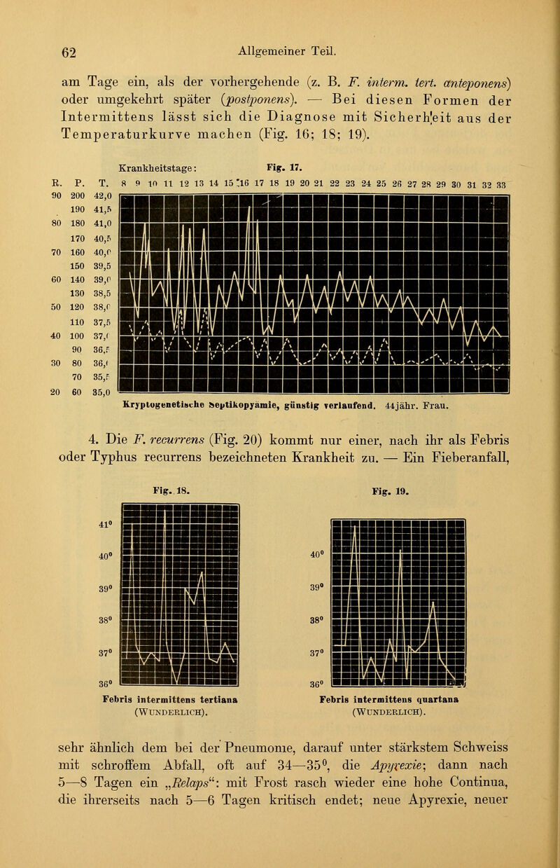 am Tage ein, als der vorhergehende (z. B. F. interm. iert. anteponens) oder umgekehrt später (postjjonens). — Bei diesen Formen der Intermittens lässt sich die Diagnose mit Sicherheit aus der Temperaturkurve machen (Fig. 16; 18; 19). R. P. 90 200 190 80 180 170 70 160 150 60 140 130 50 120 110 40 100 90 30 80 70 20 60 T. 42,0 41,5 41,0 40,5 40,0 39,5 39,0 38,5 38,0 37,5 37,( 36,P 36,( 35,f 35,0 Krankheitstage: Fig. 17. 8 9 in 11 12 13 14 15 '16 17 18 19 20 21 22 23 24 25 26 27 28 29 30 31 32 33 Ol il IBIII llHil llpinisHsnsiiiaii m Kryplugenetiüche !»eptikopyäiuie, günstig verlanfend. 44jähr. Frau. 4. Die F. recurrens (Fig. 20) kommt nur einer, nach ihr als Febris oder Typhus recurrens bezeichneten Krankheit zu. — Ein Fieberanfall, Fig. 18. Fig. 19. Febris intermittens tertiana (Wunderlich). Febris intermittens qnartana (Wunderlich). sehr ähnlich dem bei der Pneumonie, darauf unter stärkstem Schweiss mit schroffem Abfall, oft auf 34—35*^, die Apyrexie; dann nach 5—-8 Tagen ein „Relaps^^: mit Frost rasch wieder eine hohe Continua, die ihrerseits nach 5—6 Tagen kritisch endet; neue Apyrexie, neuer