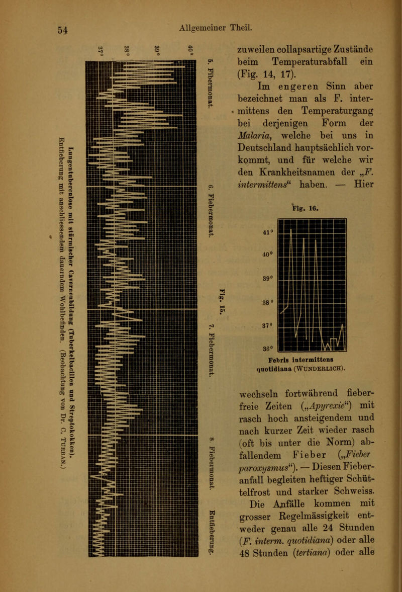 CD B o 3 9> zuweilen collapsarfcige Zustände beim Temperaturabfall ein (Fig. 14, 17). Im engeren Sinn aber bezeichnet man als F. inter- mittens den Temperatur gang bei derjenigen Form der Malaria, welche bei uns in Deutschland hauptsächlich vor- kommt, und für welche wir den Krankheitsnamen der „F. intermittens'''' haben. — Hier Fig. 16. 41« 40* 39 38 37 36« I IsinE liniB ■■[■■IBI ~ IHIIHH .iiii:!iir- nliidi' Febris intermittens qnotidiana (Wunderlich). w^echseln fortwährend fieber- freie Zeiten („Äpyrexie^^) mit rasch hoch ansteigendem und nach kurzer Zeit wieder rasch (oft bis unter die Norm) ab- fallendem Fieber {„Fieber paroxysmus). — Diesen Fieber- anfall begleiten heftiger Schüt- telfrost und starker Schweiss. Die Ajifälle kommen mit grosser Regelmässigkeit ent- weder genau alle 24 Stunden (jP. interm. quotidiana) oder alle 48 Stunden {tertiana) oder alle