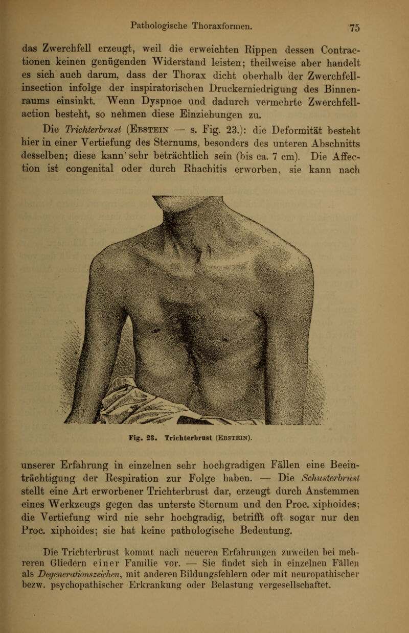 das Zwerchfell erzeugt, weil die erweichten Rippen dessen Contrac- tionen keinen genügenden Widerstand leisten; theilweise aber handelt es sich auch darum, dass der Thorax dicht oberhalb der Zwerchfell- insection infolge der inspiratorischen Druckerniedrigung des Binnen- raums einsinkt. Wenn Dyspnoe und dadurch vermehrte Zwerchfell- action besteht, so nehmen diese Einziehungen zu. Die Trichterbrust (Ebstein — s. Fig. 23.): die Deformität besteht hier in einer Vertiefung des Sternums, besonders des unteren Abschnitts desselben; diese kann' sehr beträchtlich sein (bis ca. 7 cm). Die Affec- tion ist congenital oder durch Rhachitis erworben, sie kann nach Fig. 28. Trichterbrust (Ebstein). unserer Erfahrung in einzelnen sehr hochgradigen Fällen eine Beein- trächtigung der Respiration zur Folge haben. — Die Schusterbrust stellt eine Art erworbener Trichterbrust dar, erzeugt durch Anstemmen eines Werkzeugs gegen das unterste Sternum und den Proc. xiphoides; die Vertiefung wird nie sehr hochgradig, betrifft oft sogar nur den Proc. xiphoides; sie hat keine pathologische Bedeutung. Die Trichterbrust kommt nach neueren Erfahrungen zuweilen bei meh- reren Gliedern einer Familie vor. — Sie findet sich in einzelnen Fällen als Degenerationszeichen, mit anderen Bildungsfehlern oder mit neuropathischer bezw. psychopathischer Erkrankung oder Belastung vergesellschaftet.