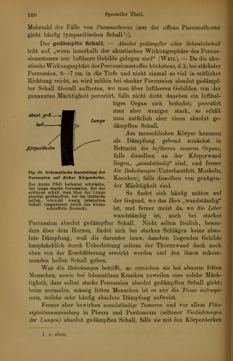 LiJun^e Mehrzahl der Fälle von Pneumothorax (nur der offene Pneumothorax giebt häufig tympanitischen Schall^)). Der gedämpfte Schall. — Absolut gedämpfter oder Schenl'elschall tritt auf, „wenn innerhalb der akustischen Wirkungssphäre des Percus- sionsstosses nur luftleere Gebilde gelegen sind (Weil). — Da die aku- stische Wirkungssphäre desPercussionsstoffes höchstens, d. h. bei stärkster Percussion, 6—7 cm in die Tiefe und nicht einmal so viel in seitlicher Richtung reicht, so v^ird mithin bei starker Percussion absolut gedämpf- ter Schall überall auftreten, V70 man über luftleeren Gebilden von der genannten Mächtigkeit percutirt, falls nicht dicht daneben ein lufthal- tiges Organ sich befindet; percutirt man aber weniger stark, so erhält man natürlich eher einen absolut ge- dämpften Schall. Am menschlichen Körper kommen als Dämpfung gebend zunächst in Betracht die luftleeren inneren Organe^ falls dieselben an der Körperwand liegen, ,,wandständig^^ sind, und ferner die Bedeckungen (ünterhautfett, Muskeln, Knochen), falls dieselben von genügen- der Mächtigkeit sind. So findet sich häufig mitten auf der Gegend, wo das He7'z „wandständig ist, und ferner meist da, wo die Leber wandständig ist, auch bei starker Percussion absolut gedämpfter Schall. Nicht selten freilich, beson- ders über dem Herzen, findet sich bei starken Schlägen keine abso- lute Dämpfung, weil die darunter bezw. daneben liegenden Gebilde hauptsächlich durch Ueberleitung seitens der Thoraxwand doch noch eben von der Erschütterung erreicht werden und den ihnen zukom- menden hellen Schall geben. Was die Bedeckungen betrifft, s.o erreichen sie bei abnorm fetten Menschen, sowie bei ödematösen Kranken zuweilen eine solche Mäch- tigkeit, dass selbst starke Percussion absolut gedämpften Schall giebt; beim normalen, massig fetten Menschen ist es nur die Fossa infraspi- nata^ welche sehr häufig absolute Dämpfung aufweist. Ferner aber bewirken wandständige Tumoren und vor allem Flüs- sigkeitsansammlung in Pleura und Peritoneum (seltener Verdichtungen der Lungen) absolut gedämpften Schall, falls sie mit den Körperdecken JCörjurdeche, Fig. 2S. Schematische Darstellong der Percussion aof dicker Körperdecke. Der kurze Pfeil bedeutet schwache, der lange starke Percussion. Bei der ersteren erhält man über der Lunge absolut gedämpften, bei der letzteren hellen, wiewohl wenig intensiven Schall (angedeutet durch das kleine schraffirte Dreieck).